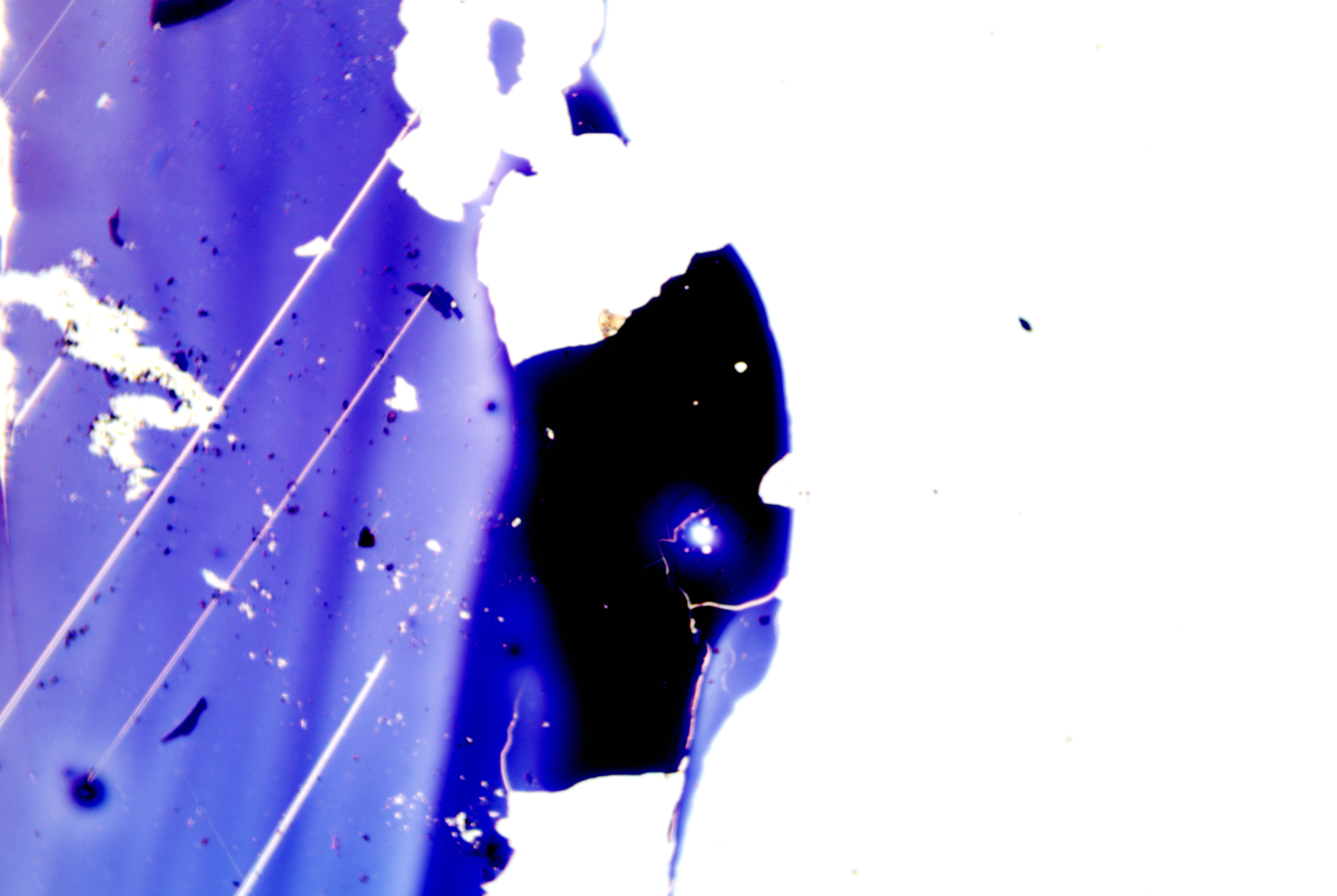 Clostridium tetani (15).png