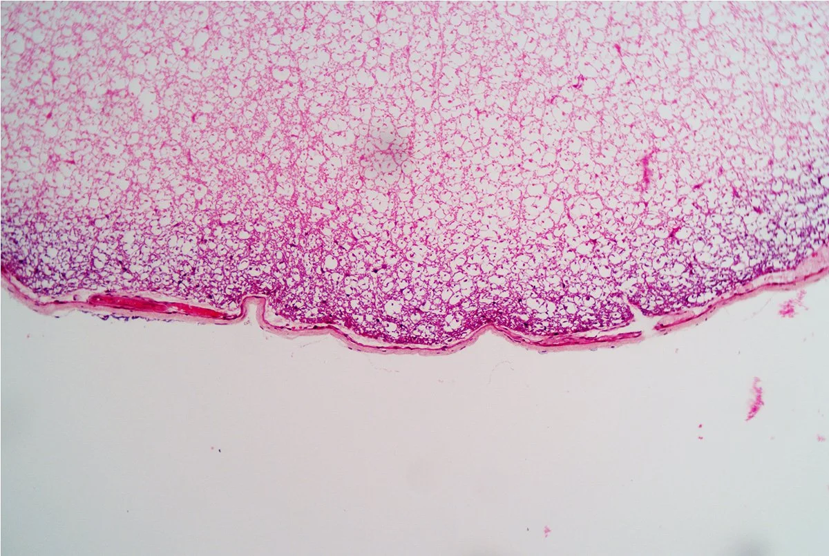 Spinal Cord Cross Section 5.jpg