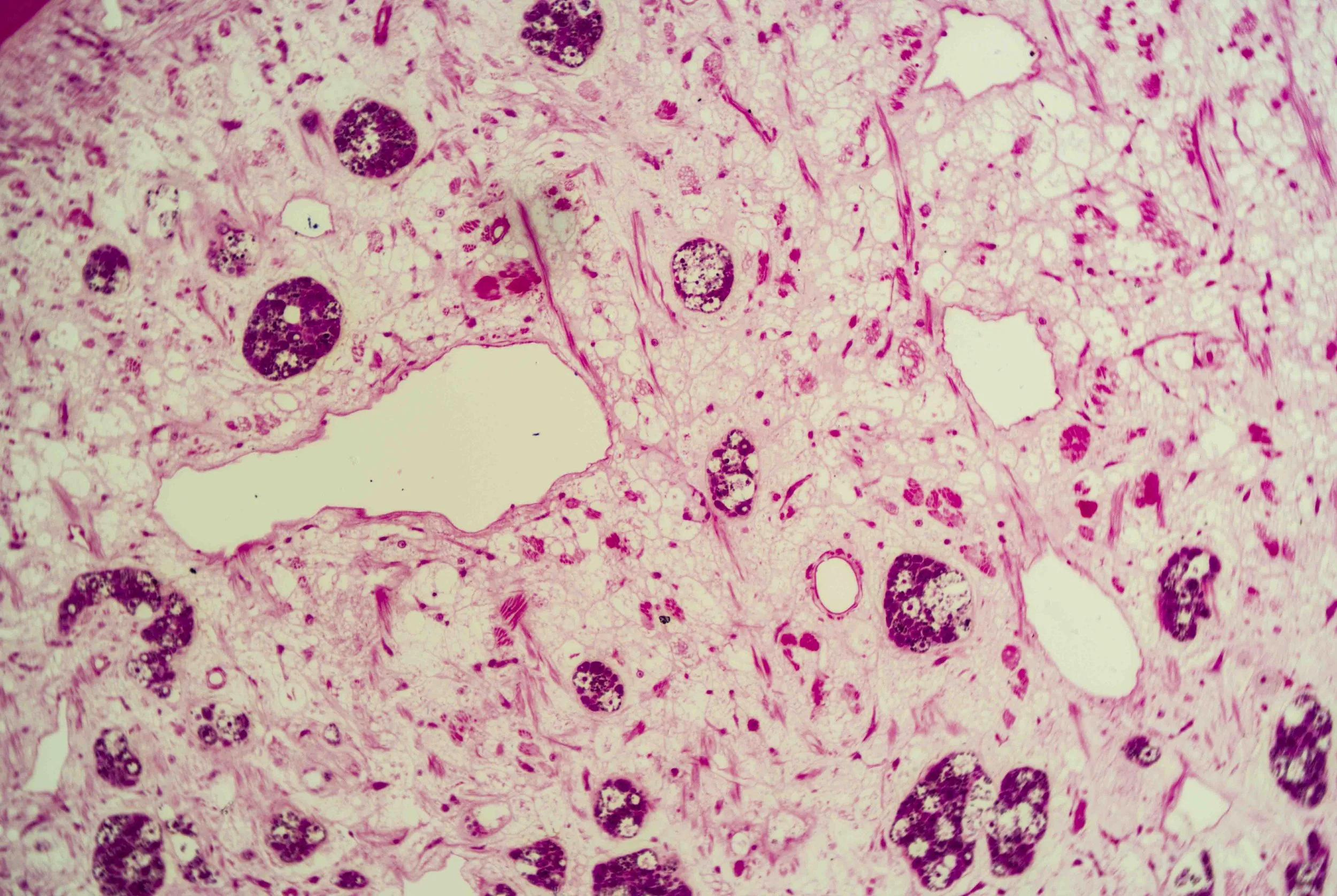 Liver Fluke Section optimized_3.jpg