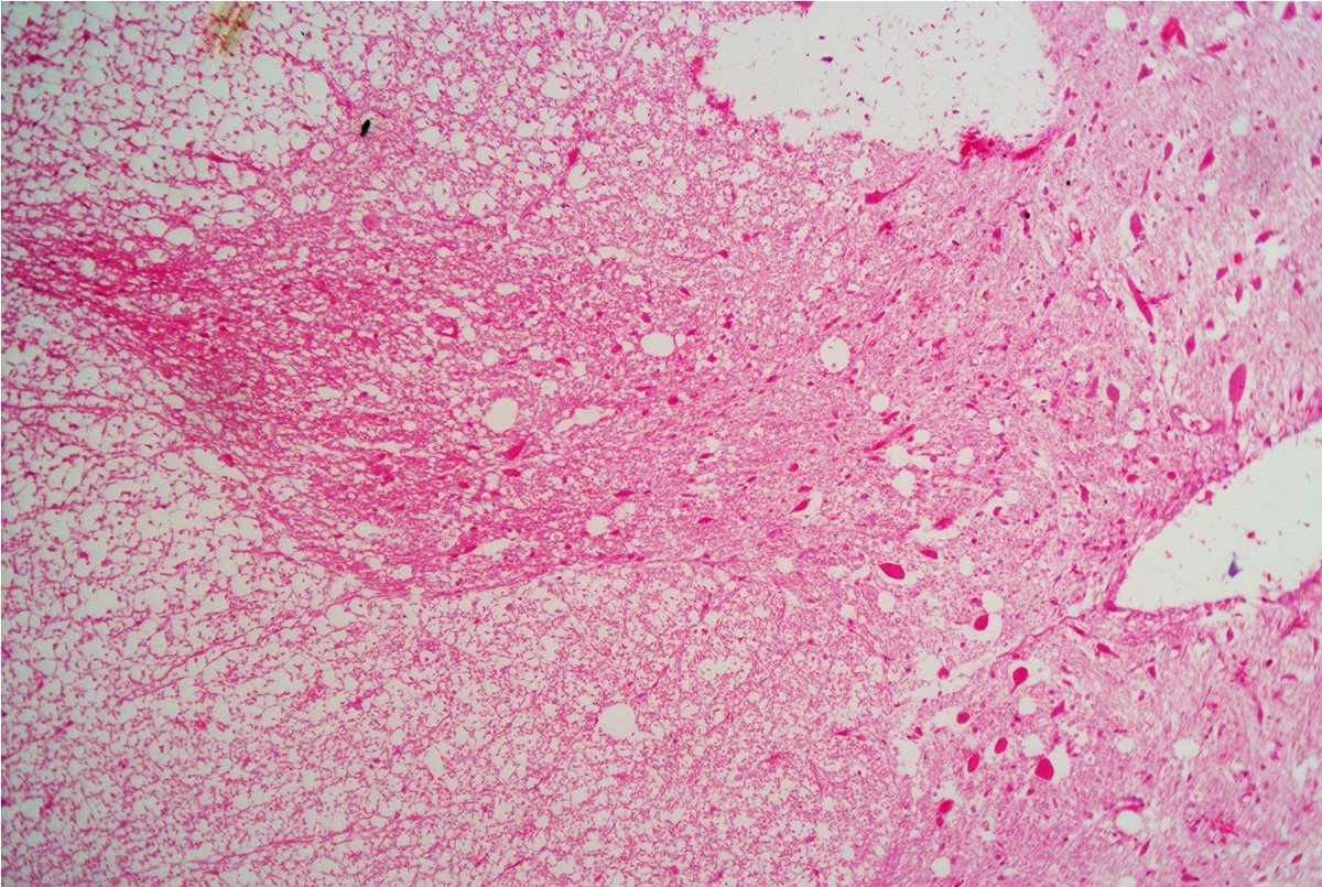 Spinal Cord Cross Section 3.jpg