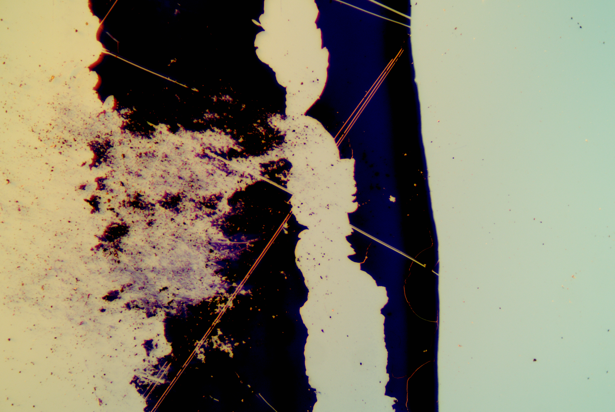 Clostridium tetani (10).png