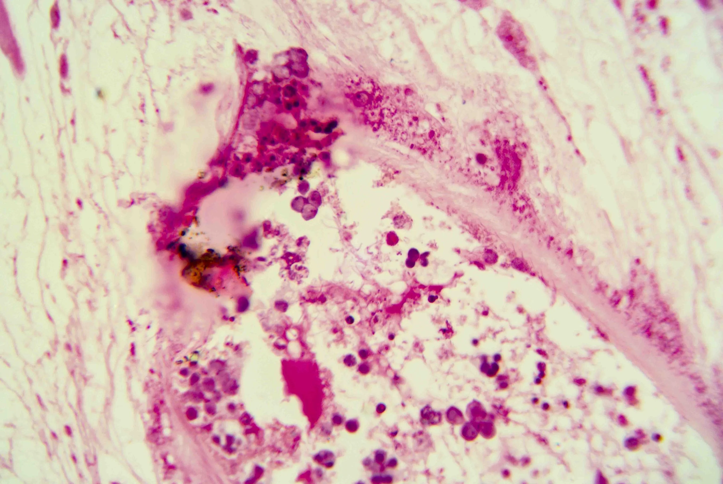 Liver Fluke Section optimized_6.jpg