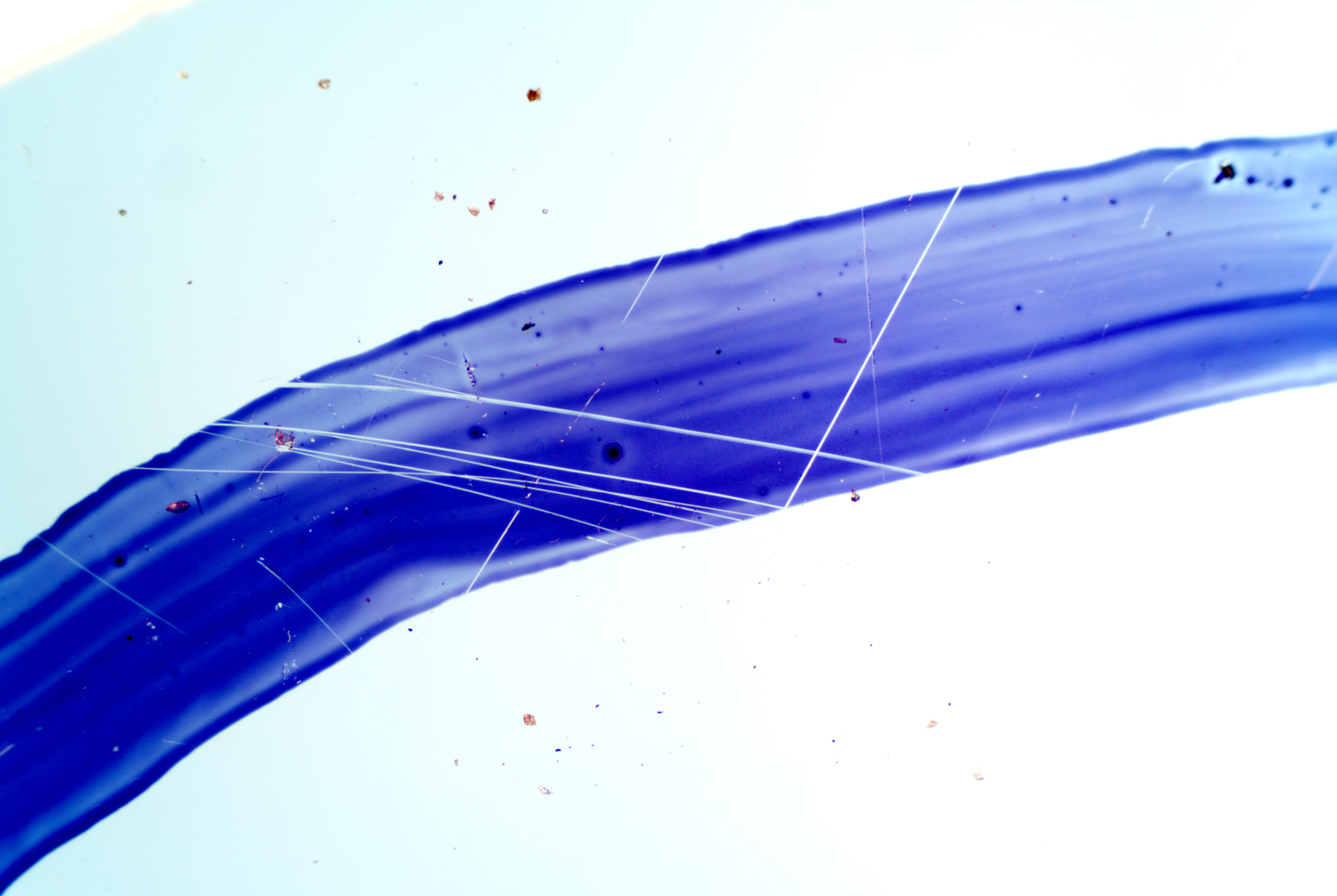 Clostridium tetani (14).png