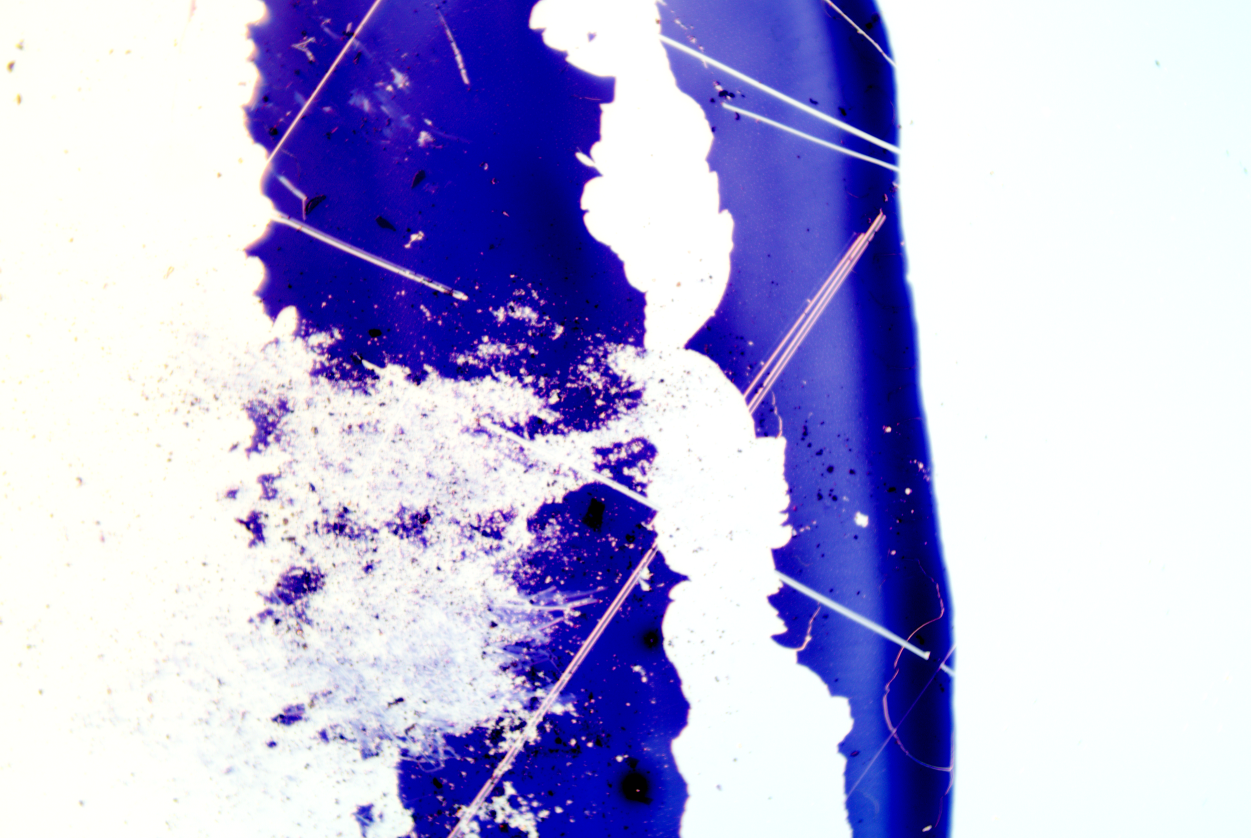 Clostridium tetani (6).png