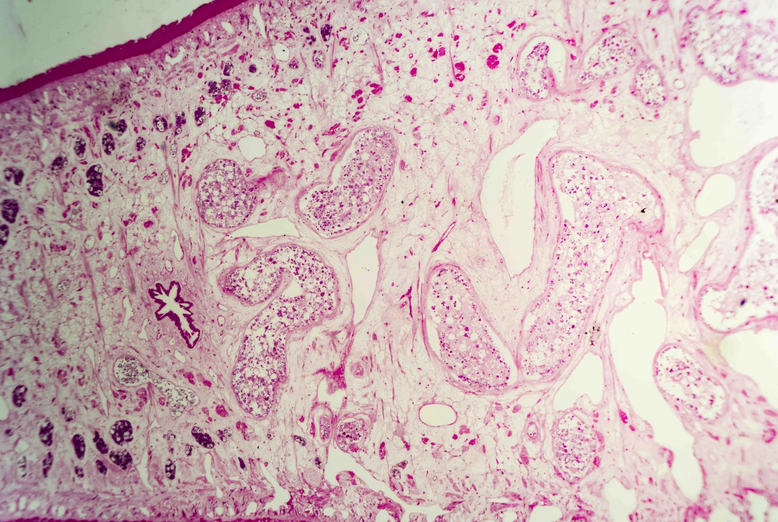 Liver Fluke Section optimized_2.jpg