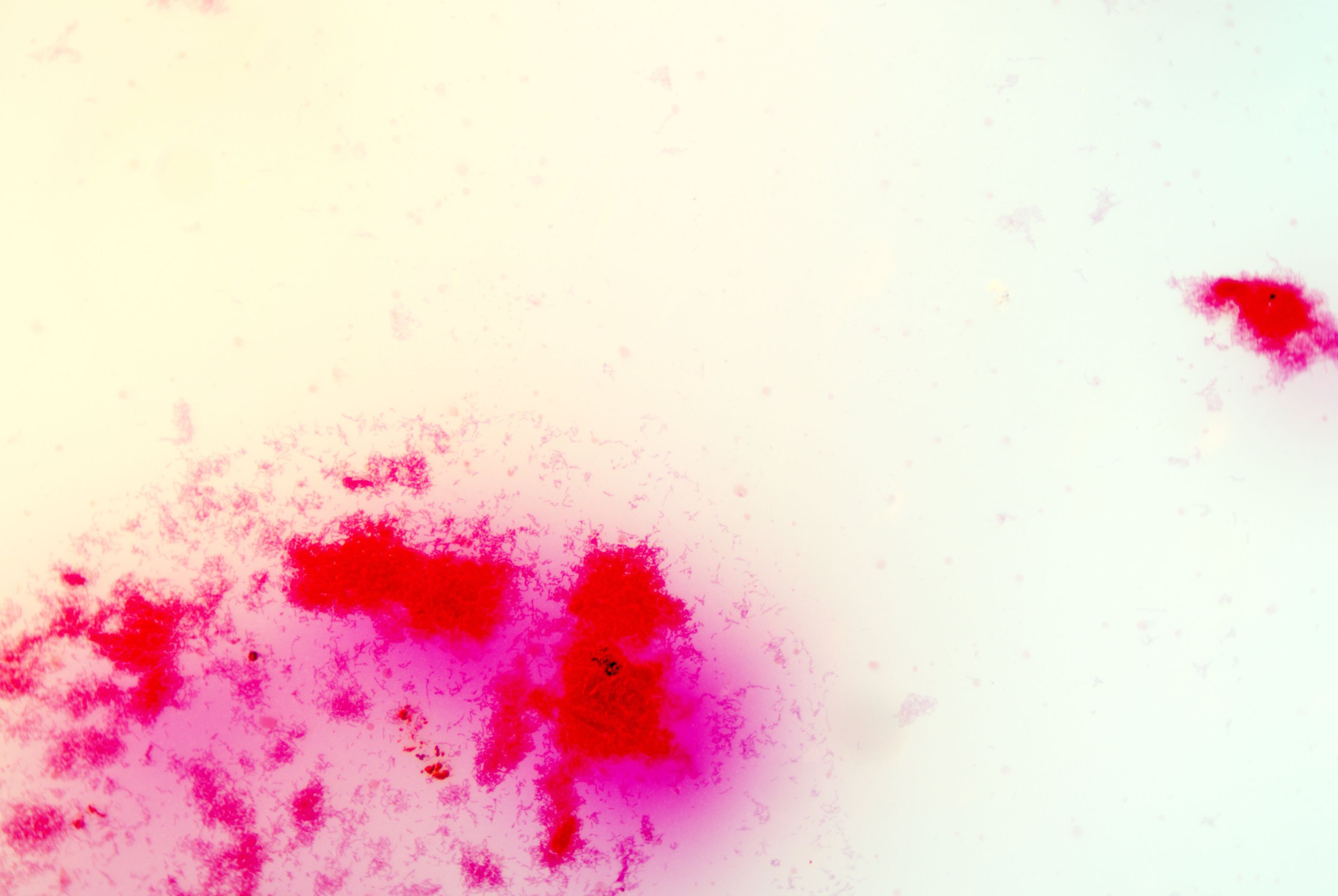 bacilus anthracis20251216233721521.jpg