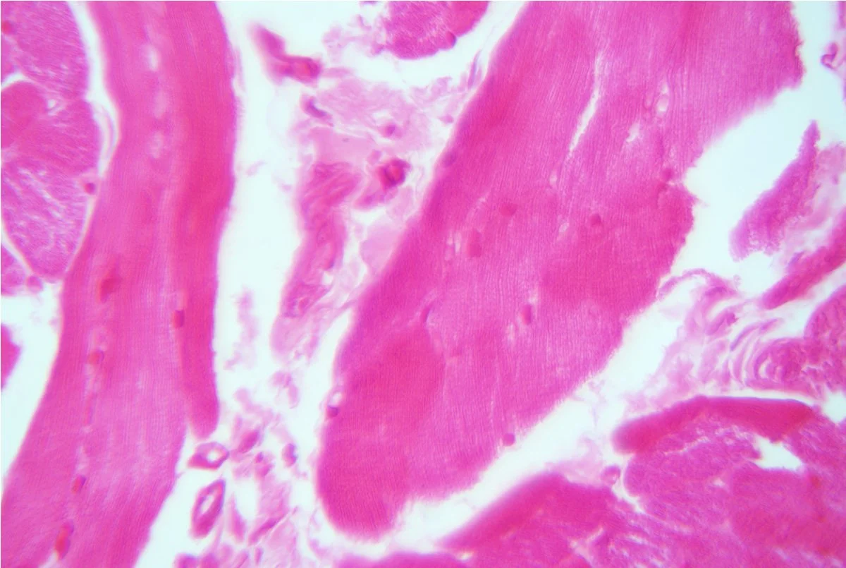 Tongue LS 9.jpg