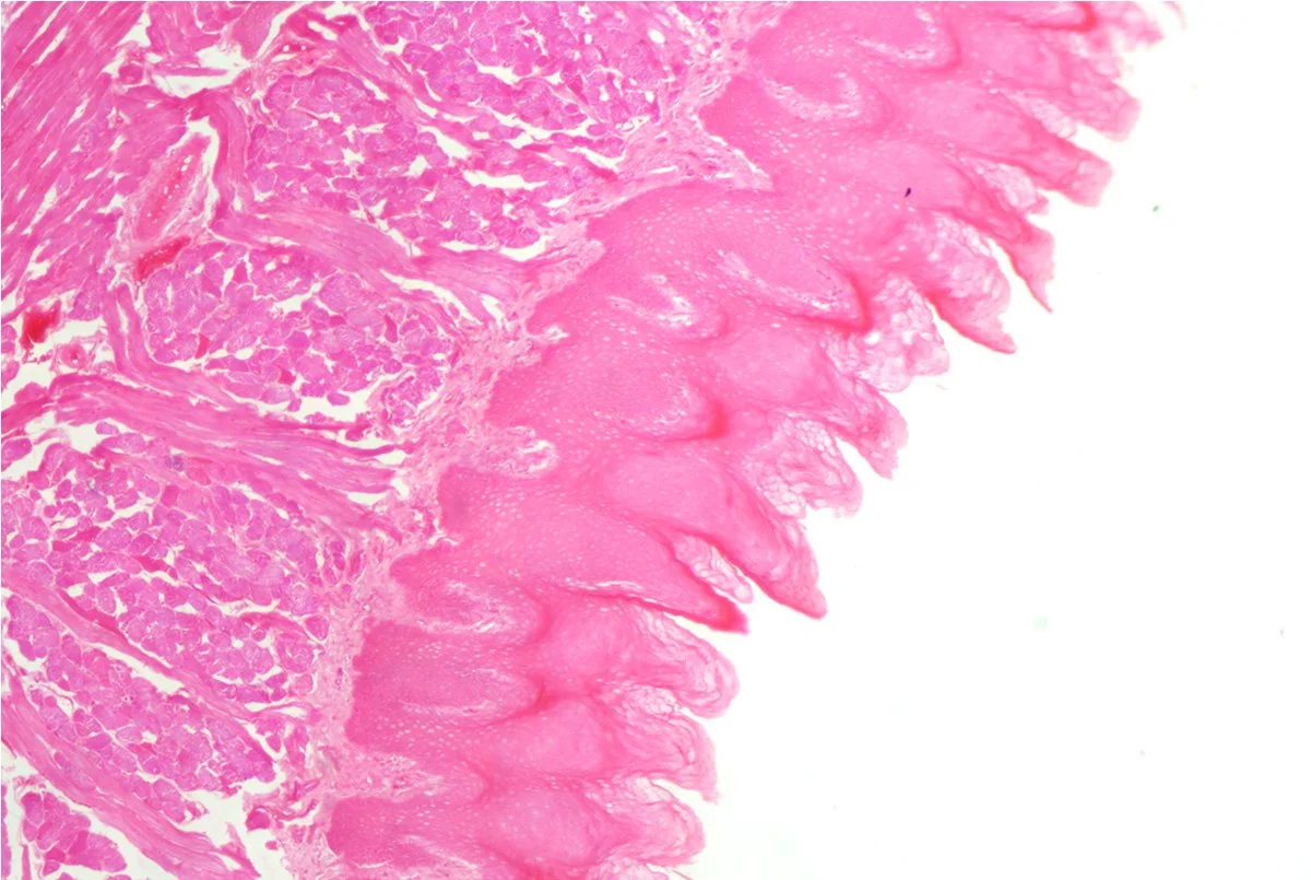 Tongue LS 7.jpg