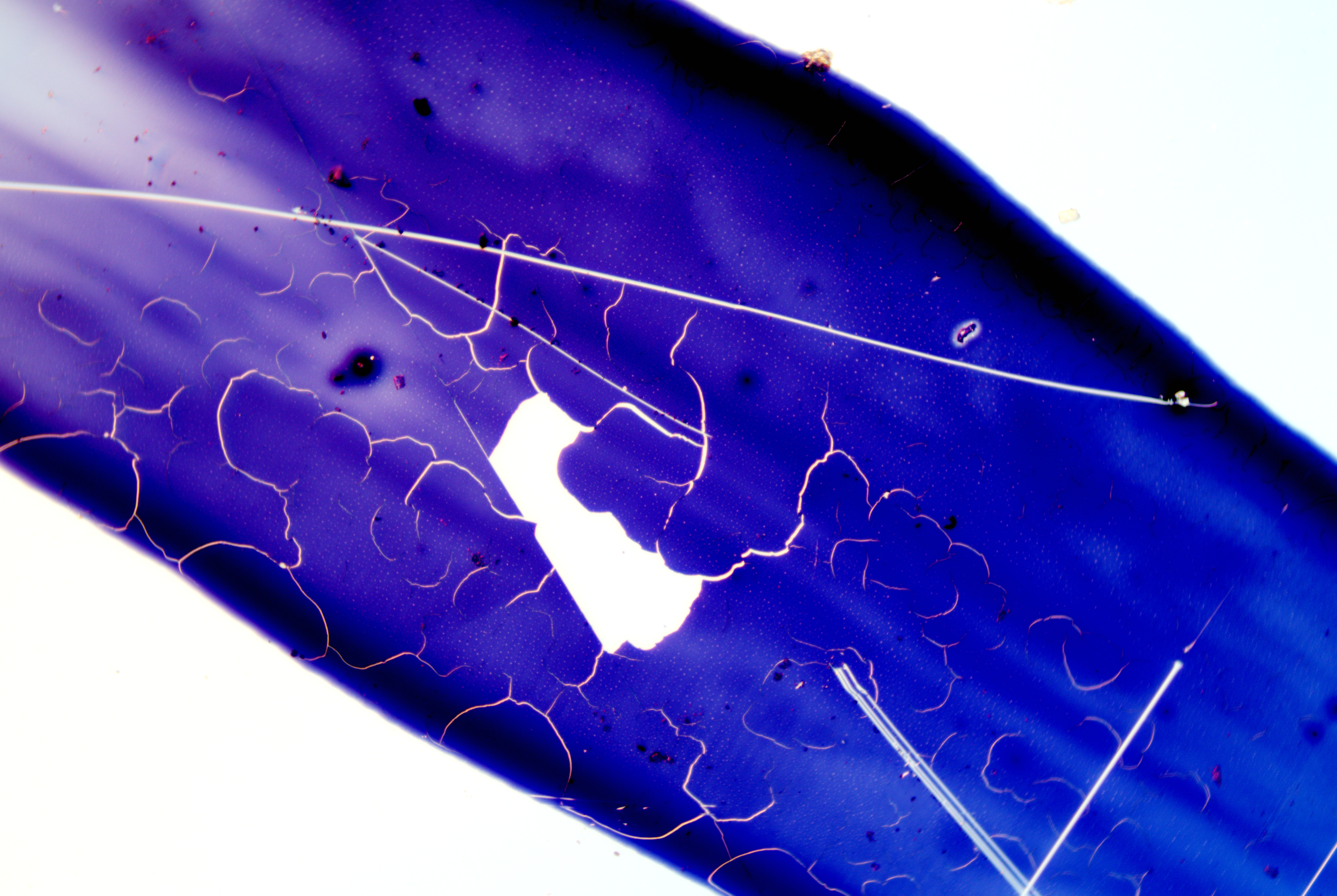 Beautiful Pathogen Pathogen & Bacterium Gallery — Bacterium is Beautiful