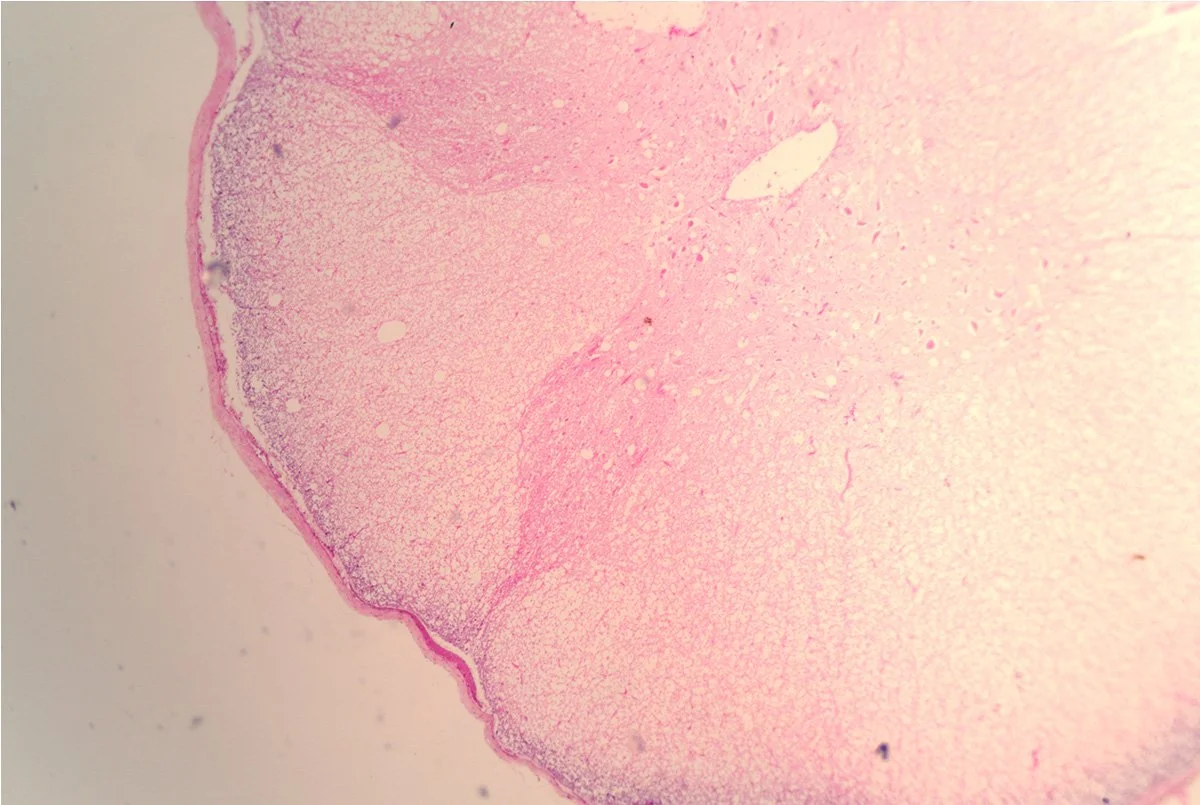 Spinal Cord Cross Section 1.jpg