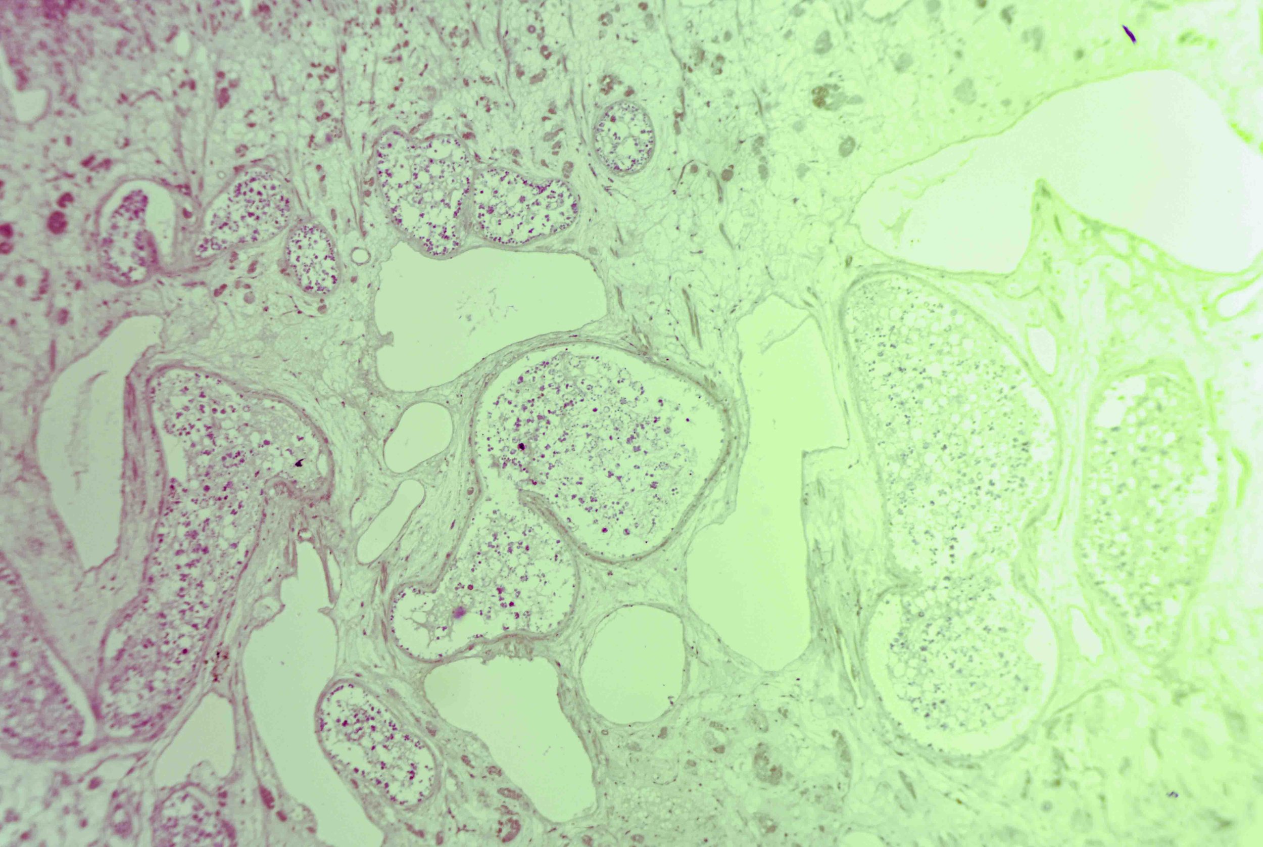 Liver Fluke Section optimized.jpg