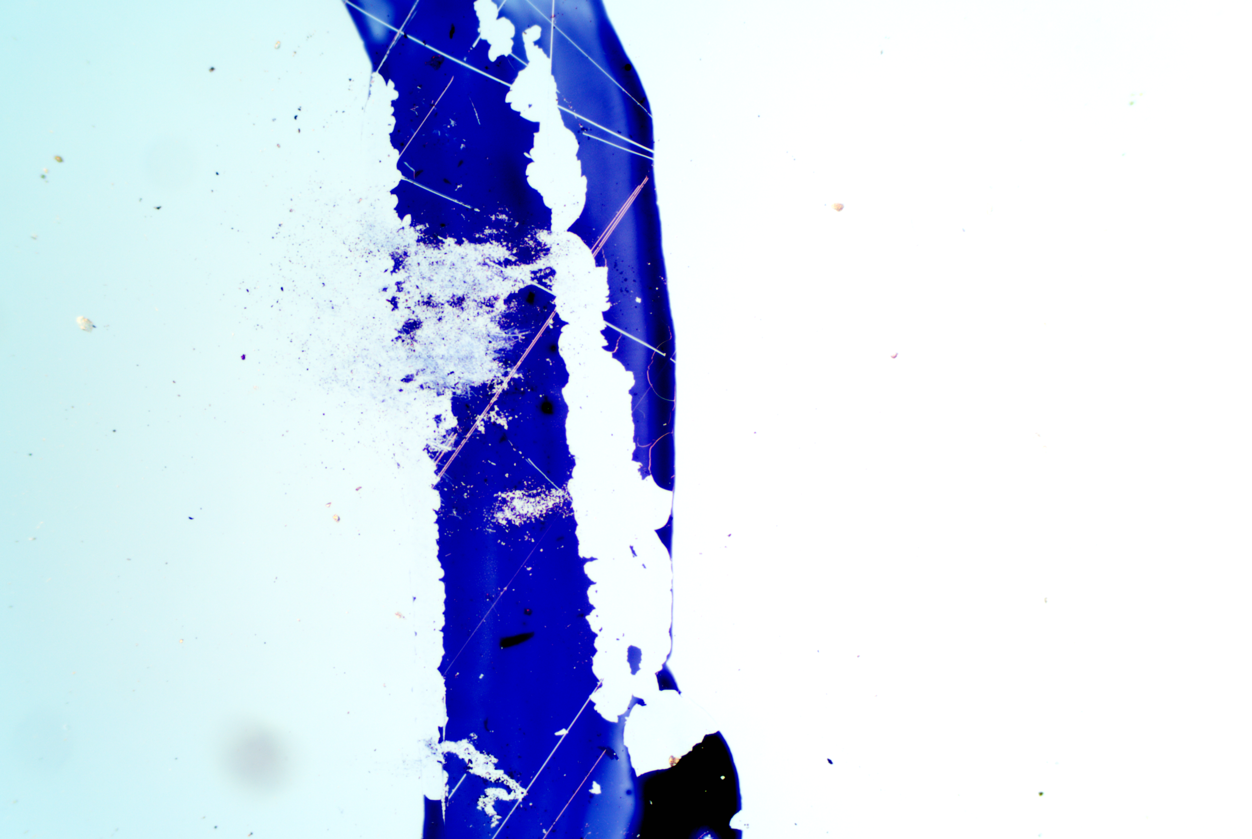 Clostridium tetani (1).png