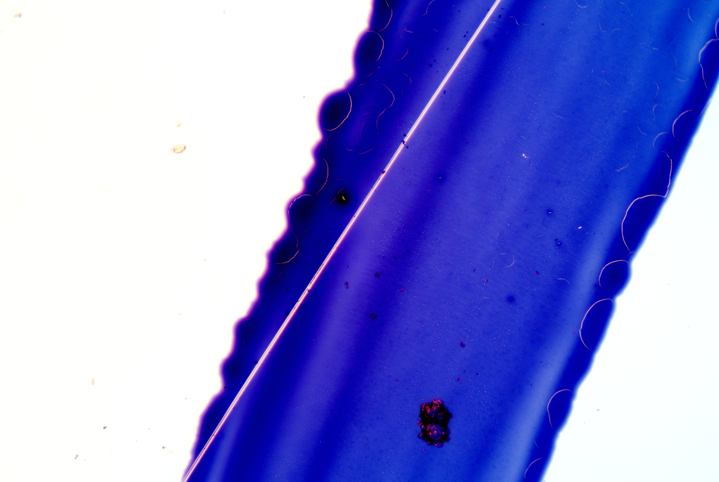 Clostridium tetani (9).png