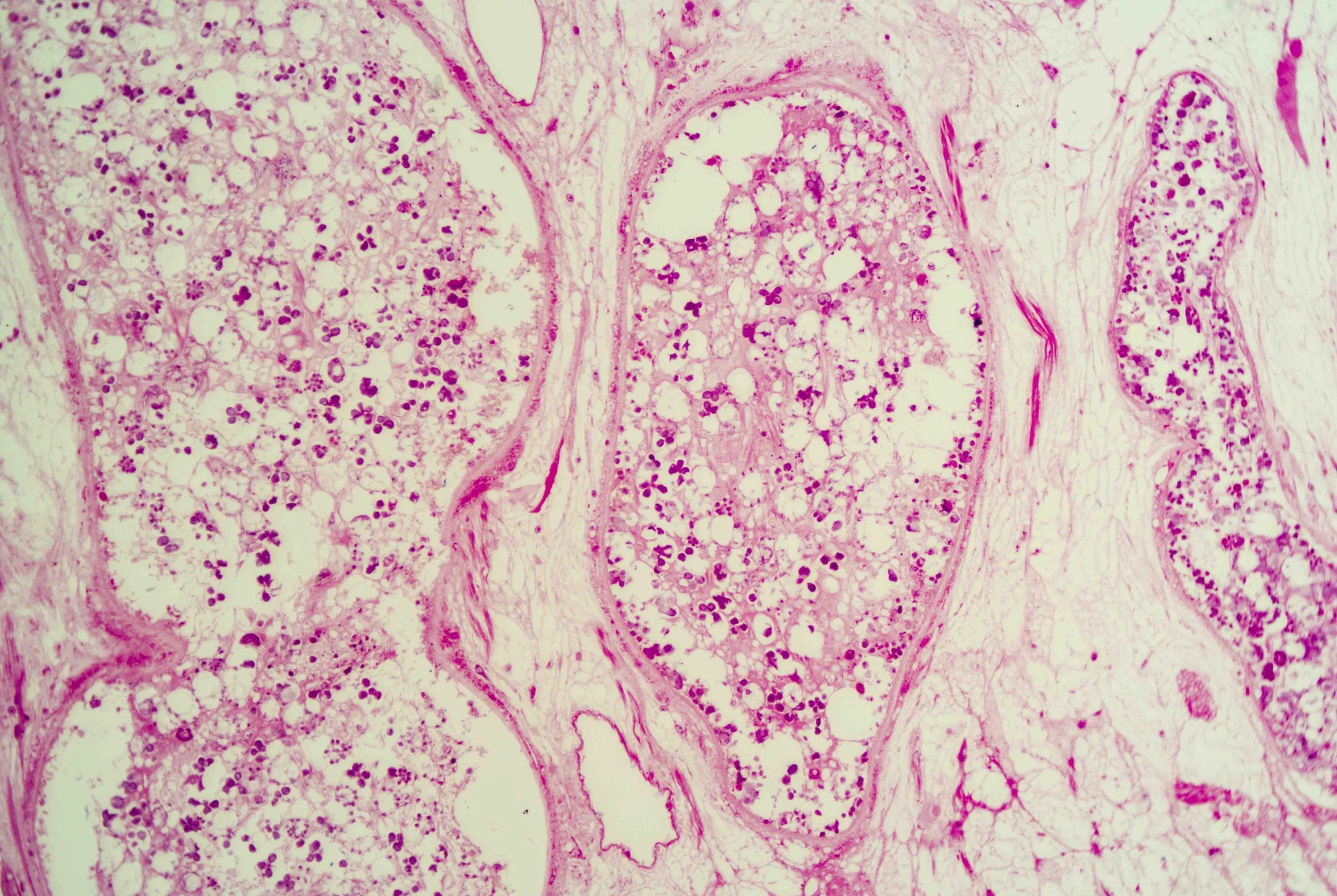 Liver Fluke Section optimized_4.jpg