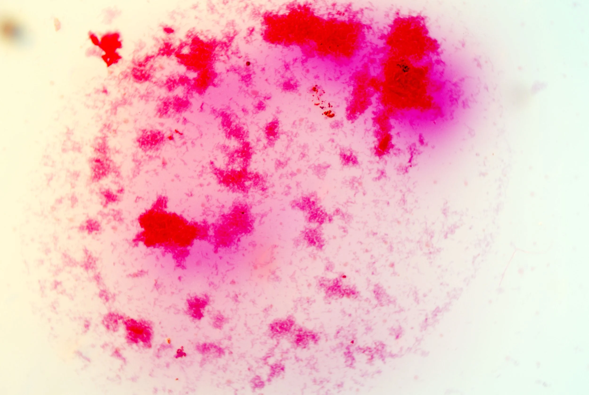 bacilus anthracis20251216233654299.jpg