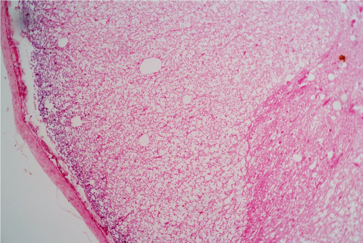 Spinal Cord Cross Section 6.jpg