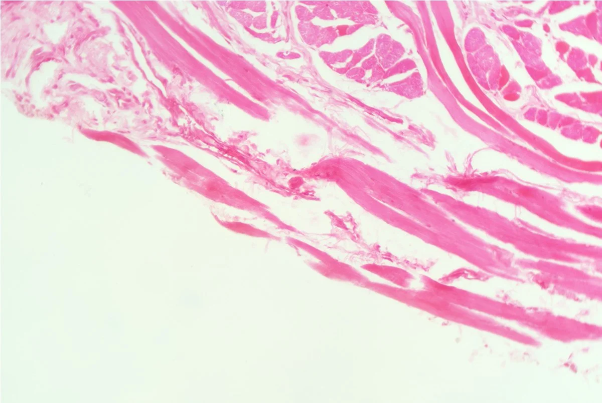 Tongue LS 3.jpg