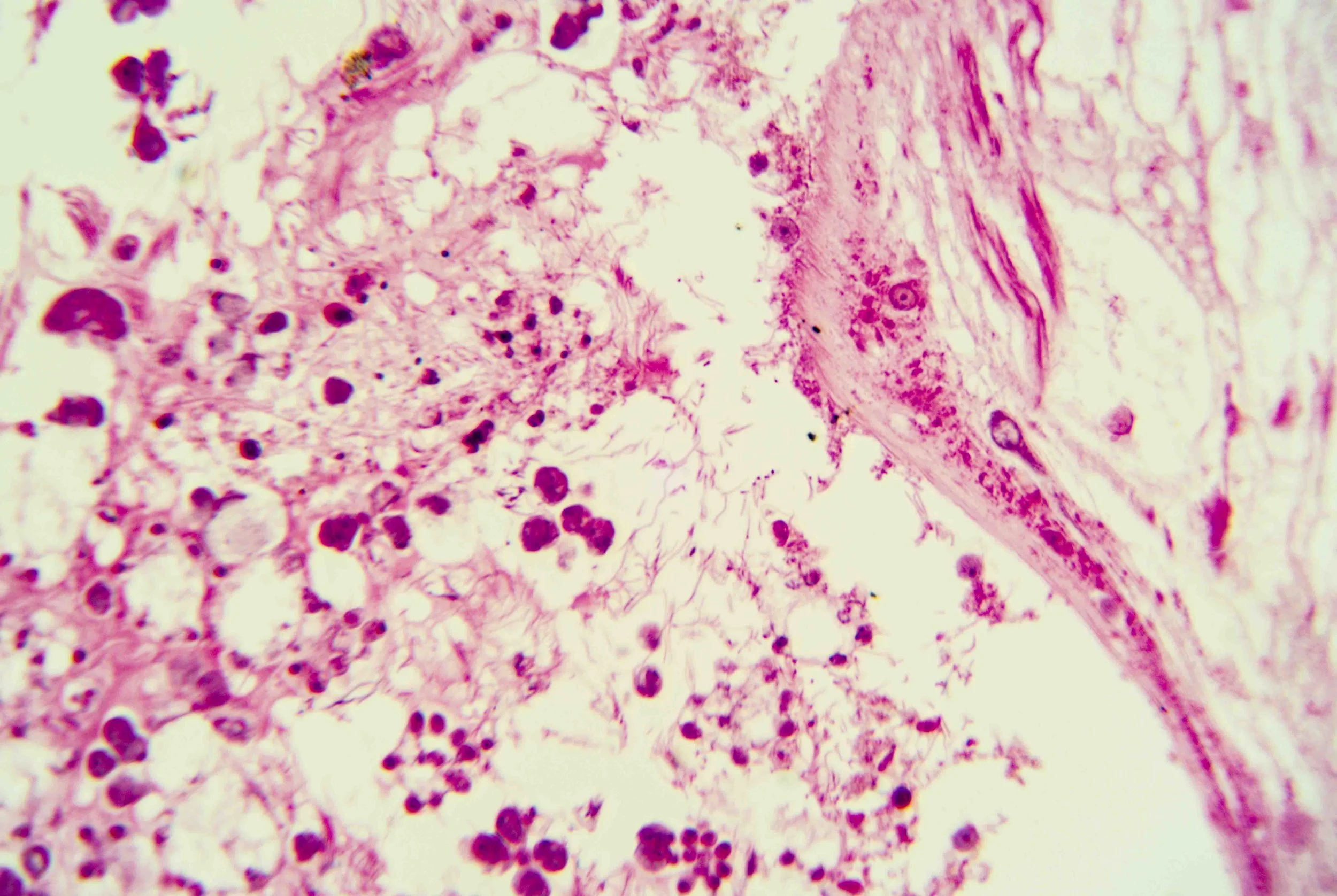 Liver Fluke Section optimized_7.jpg