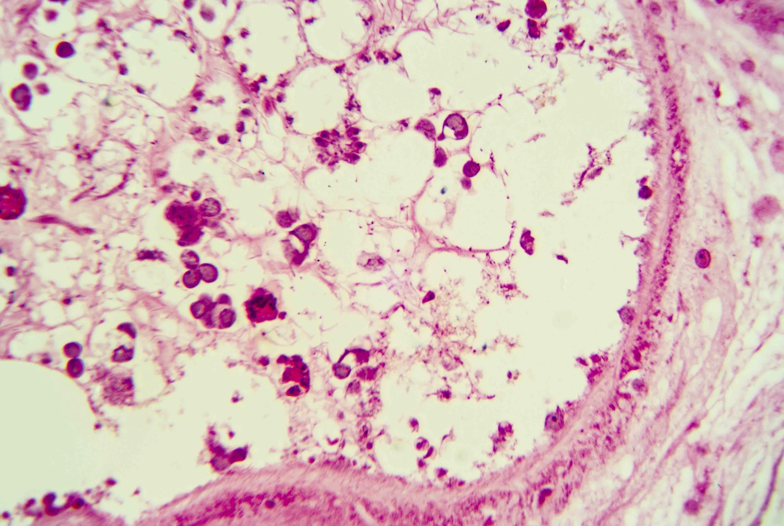 Liver Fluke Section optimized_8.jpg