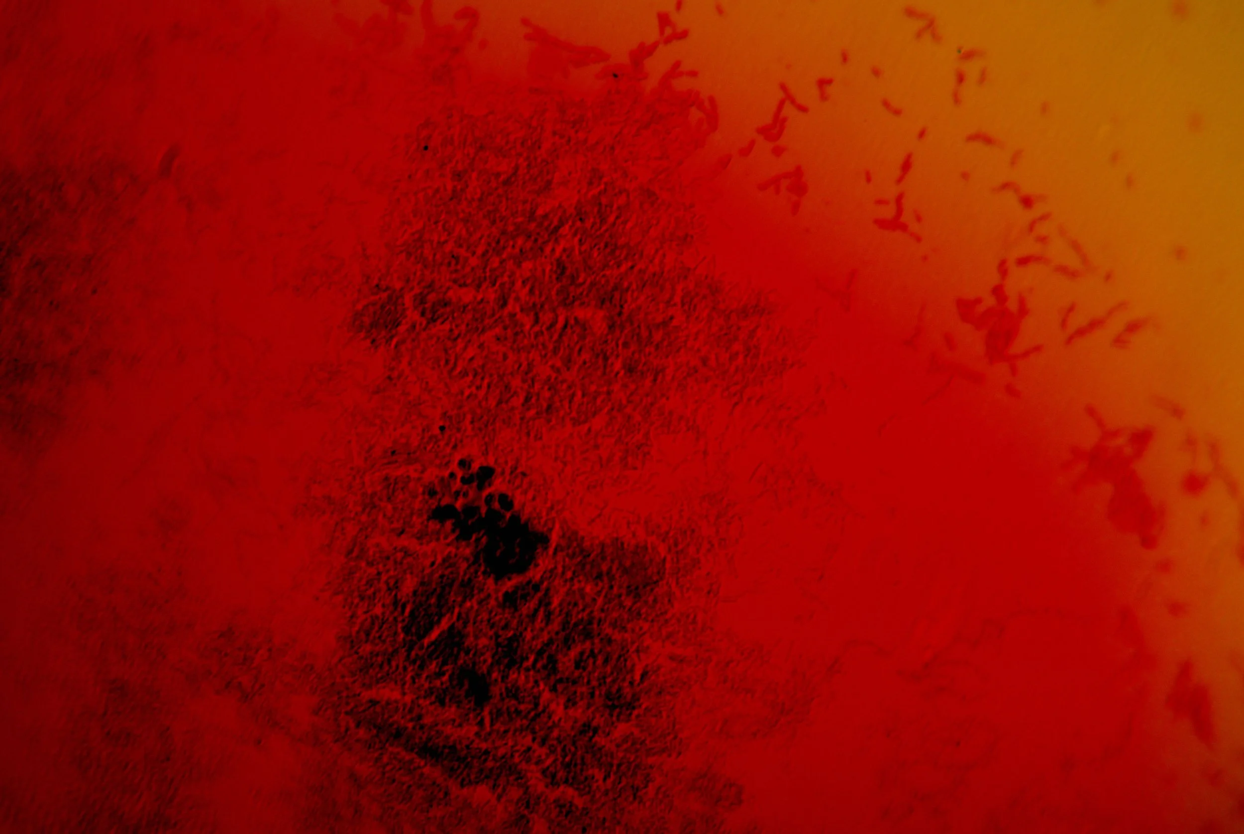 bacilus anthracis20251216233835226.jpg