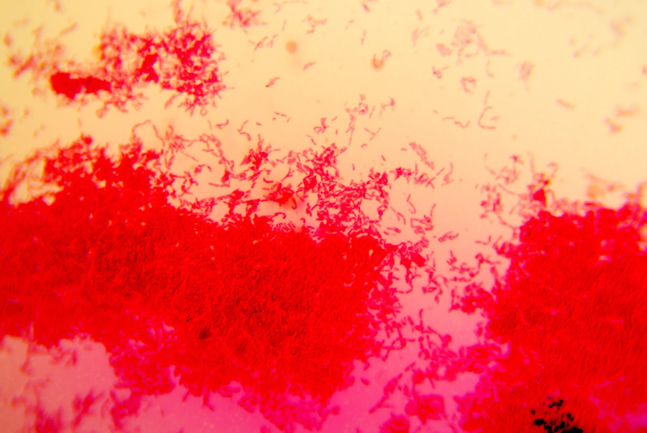 bacilus anthracis20251216234232789.jpg