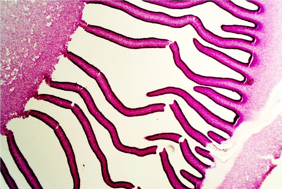 Onion Epidermis 5.jpg