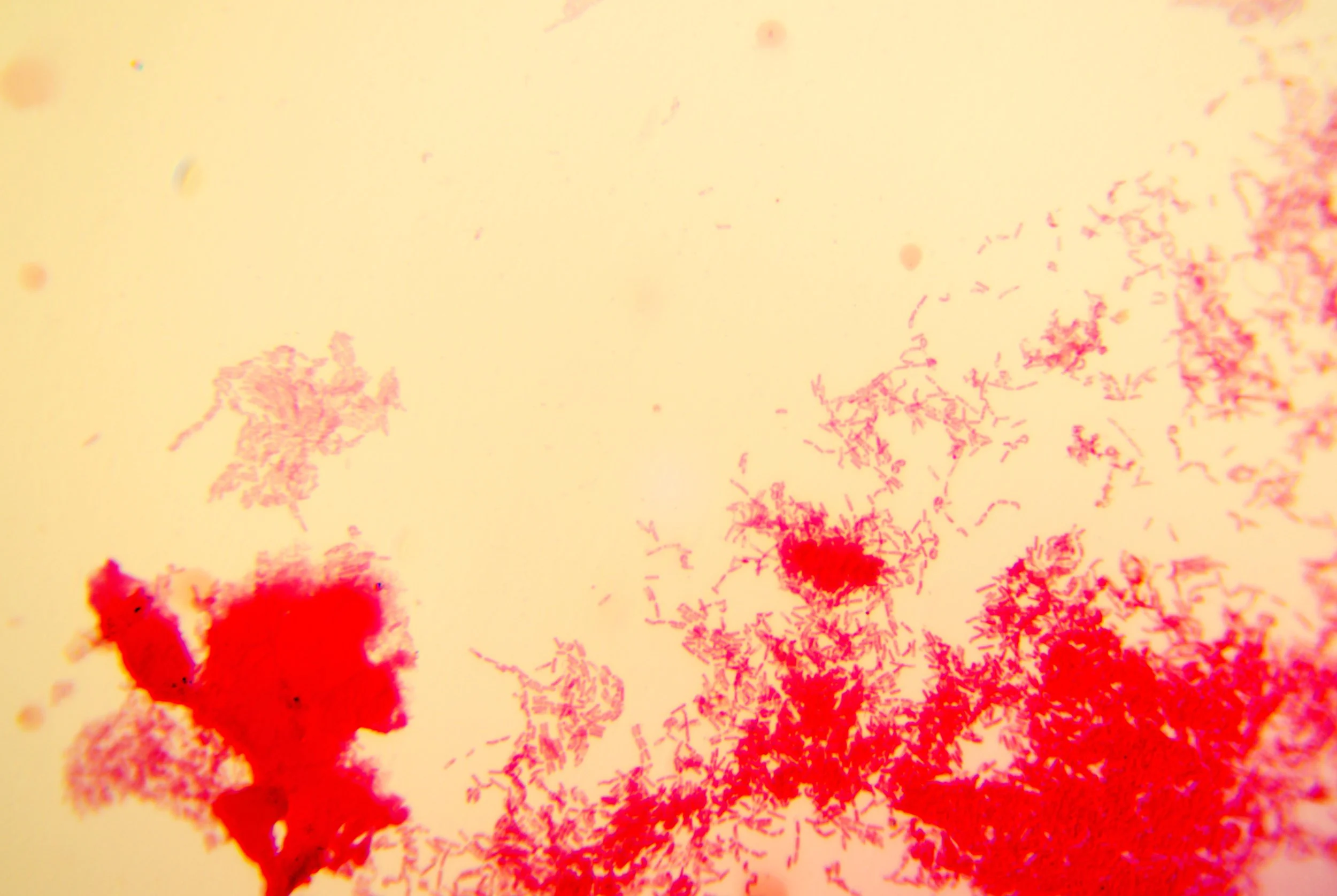 bacilus anthracis20251216234212923.jpg