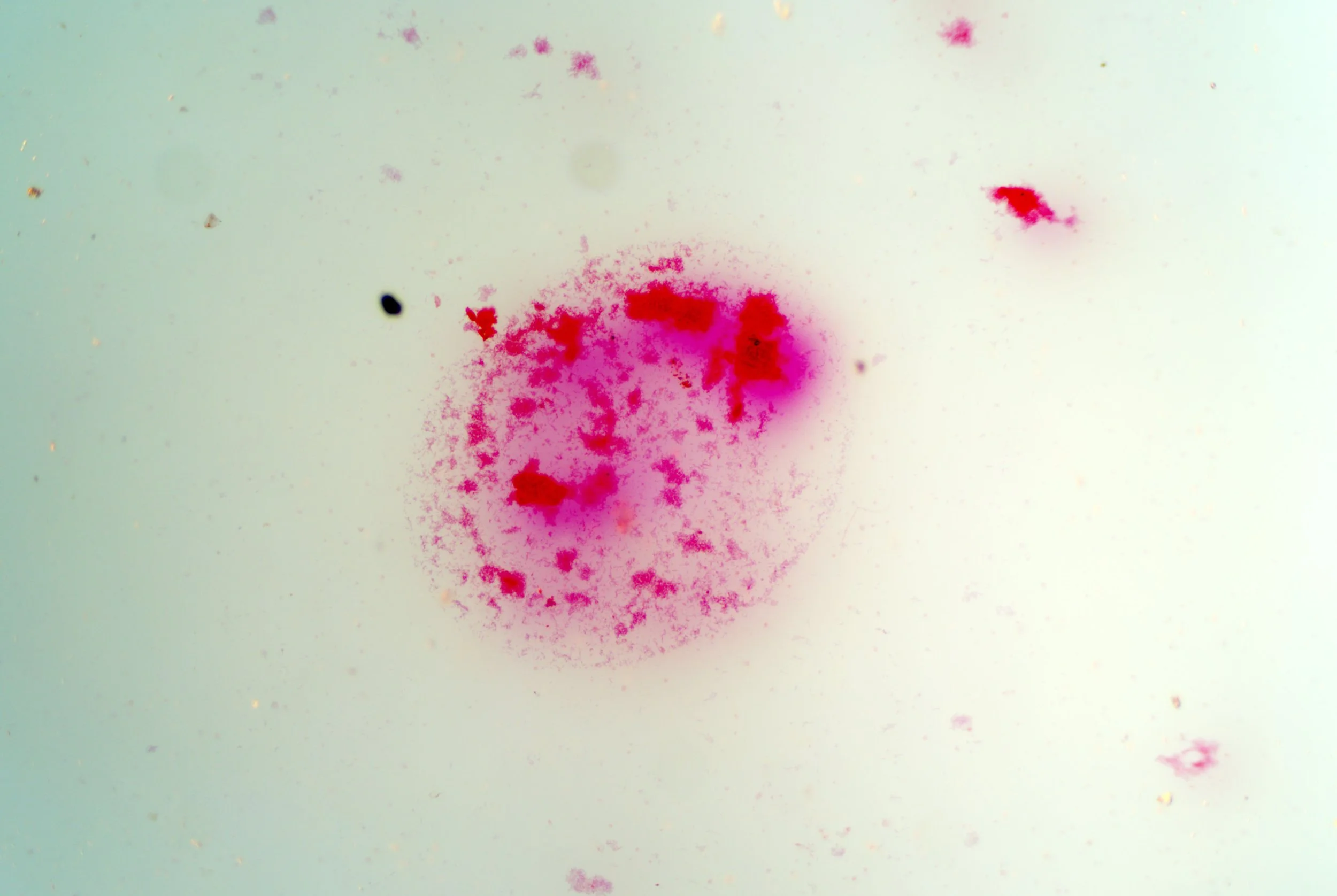 bacilus anthracis20251216233637803.jpg