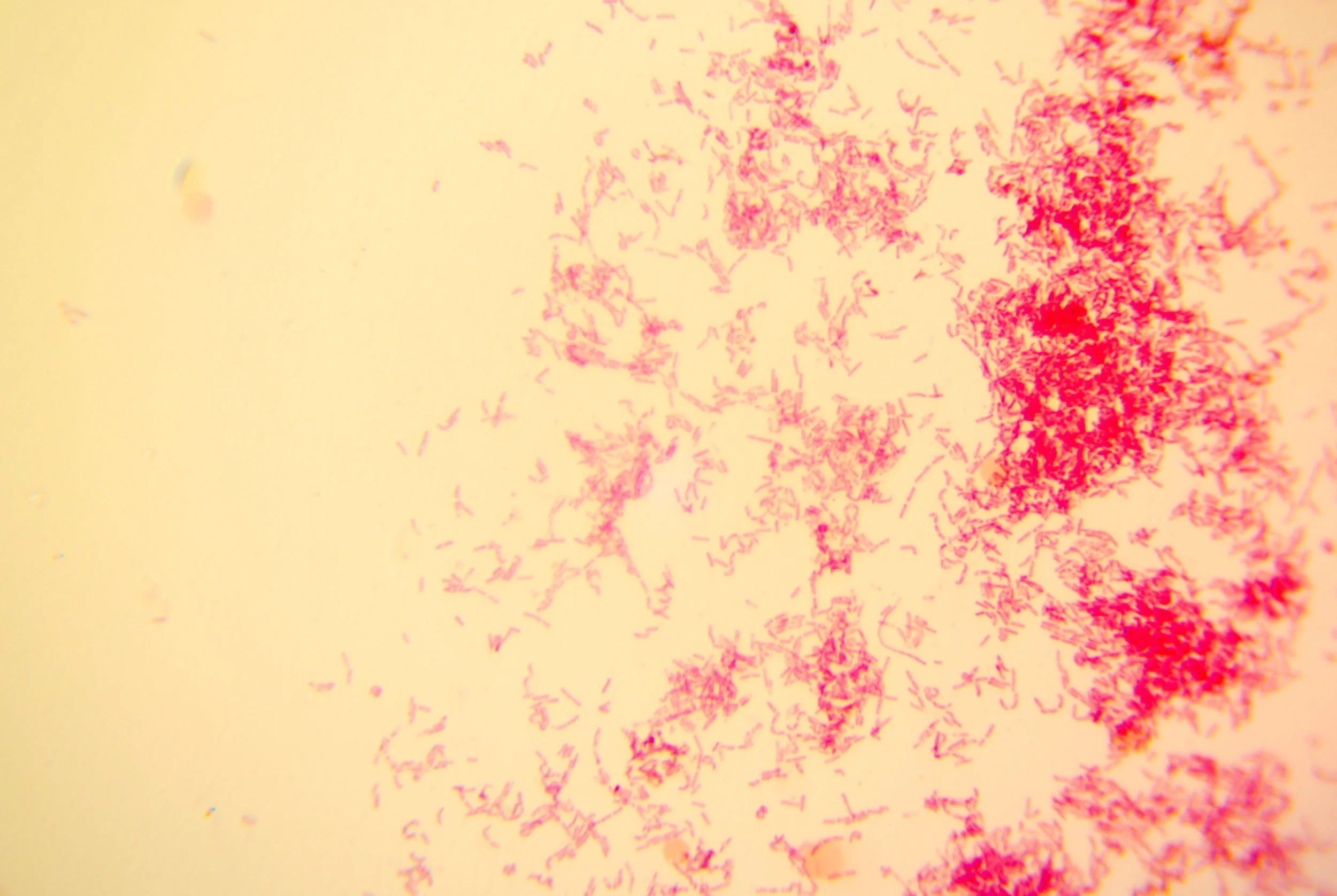 bacilus anthracis20251216234144792.jpg