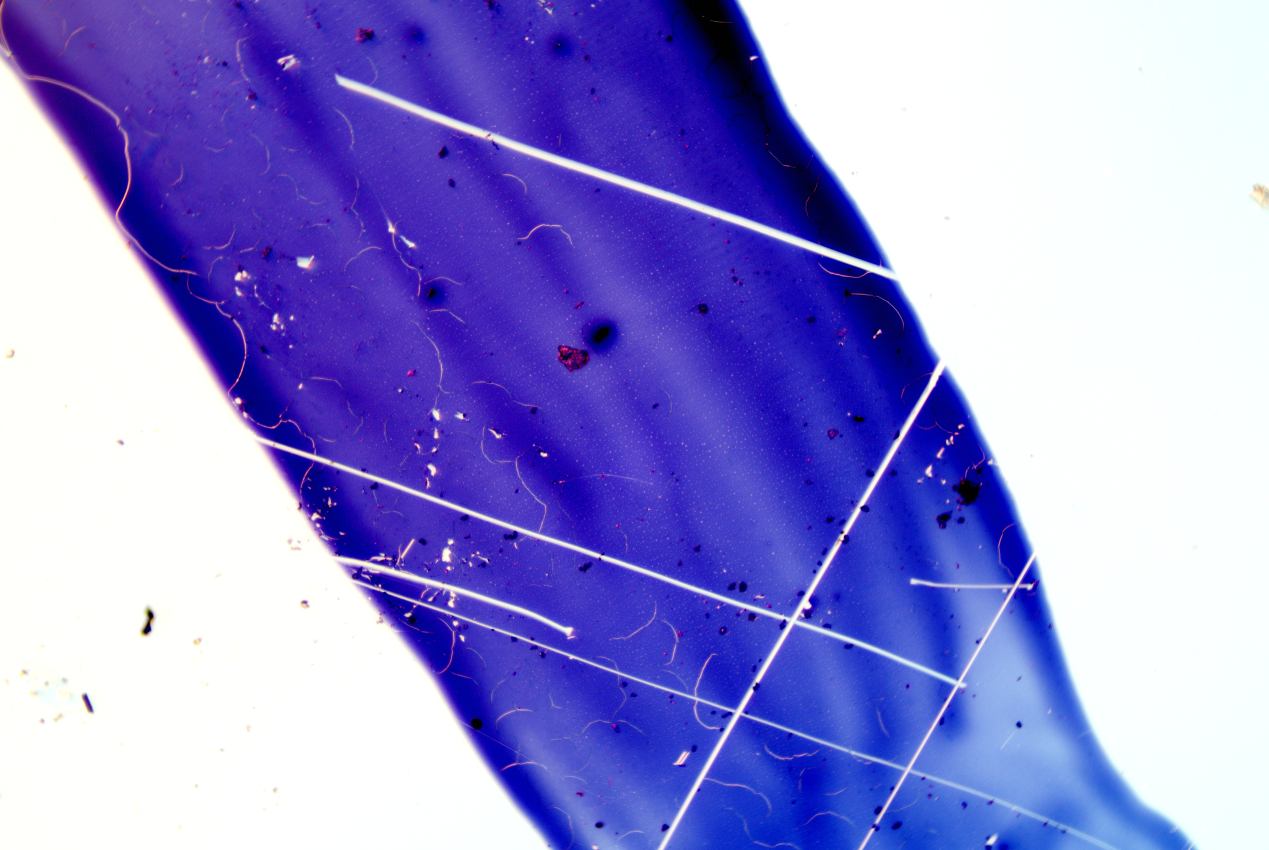 Clostridium tetani (7).png