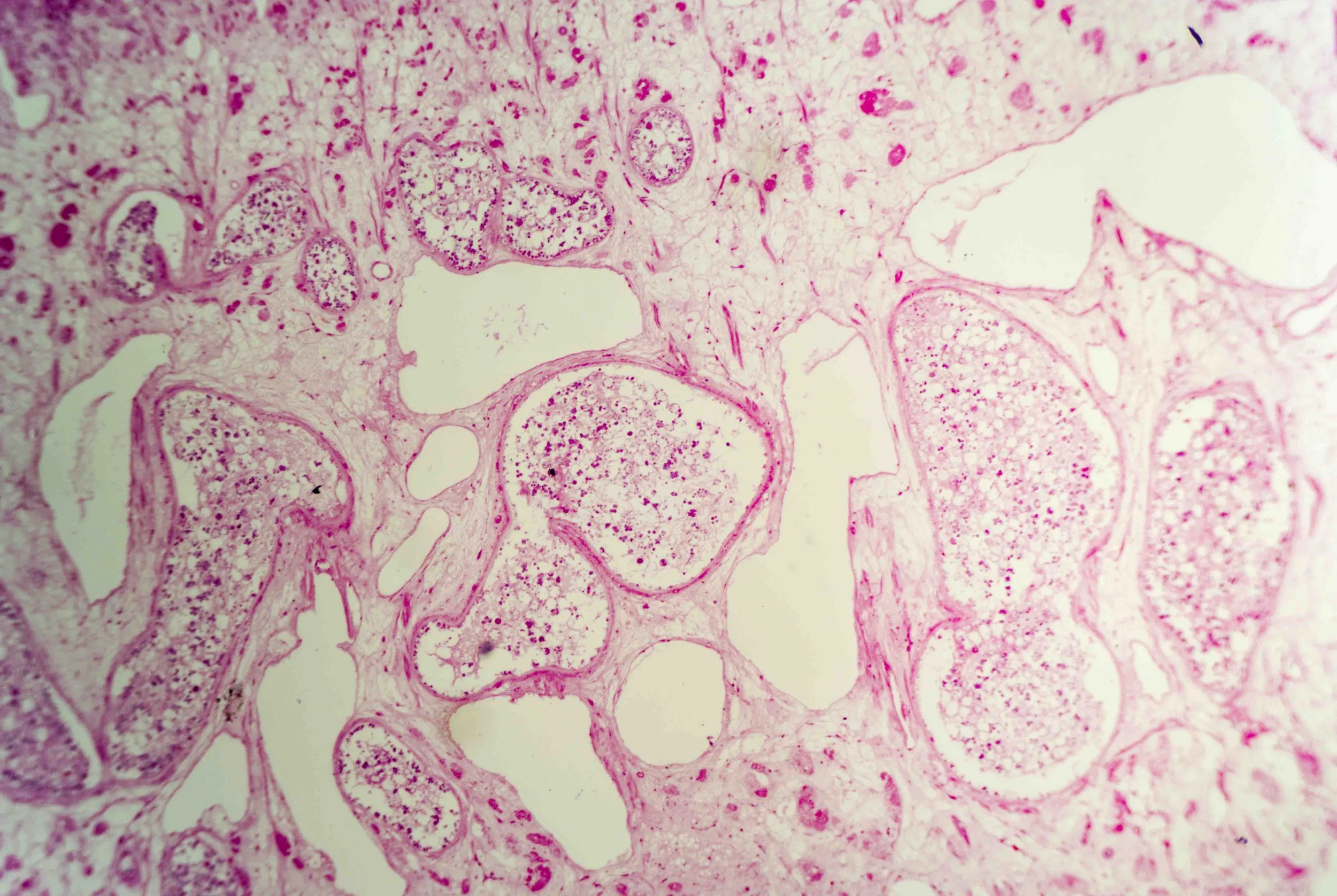 Liver Fluke Section optimized_1.jpg