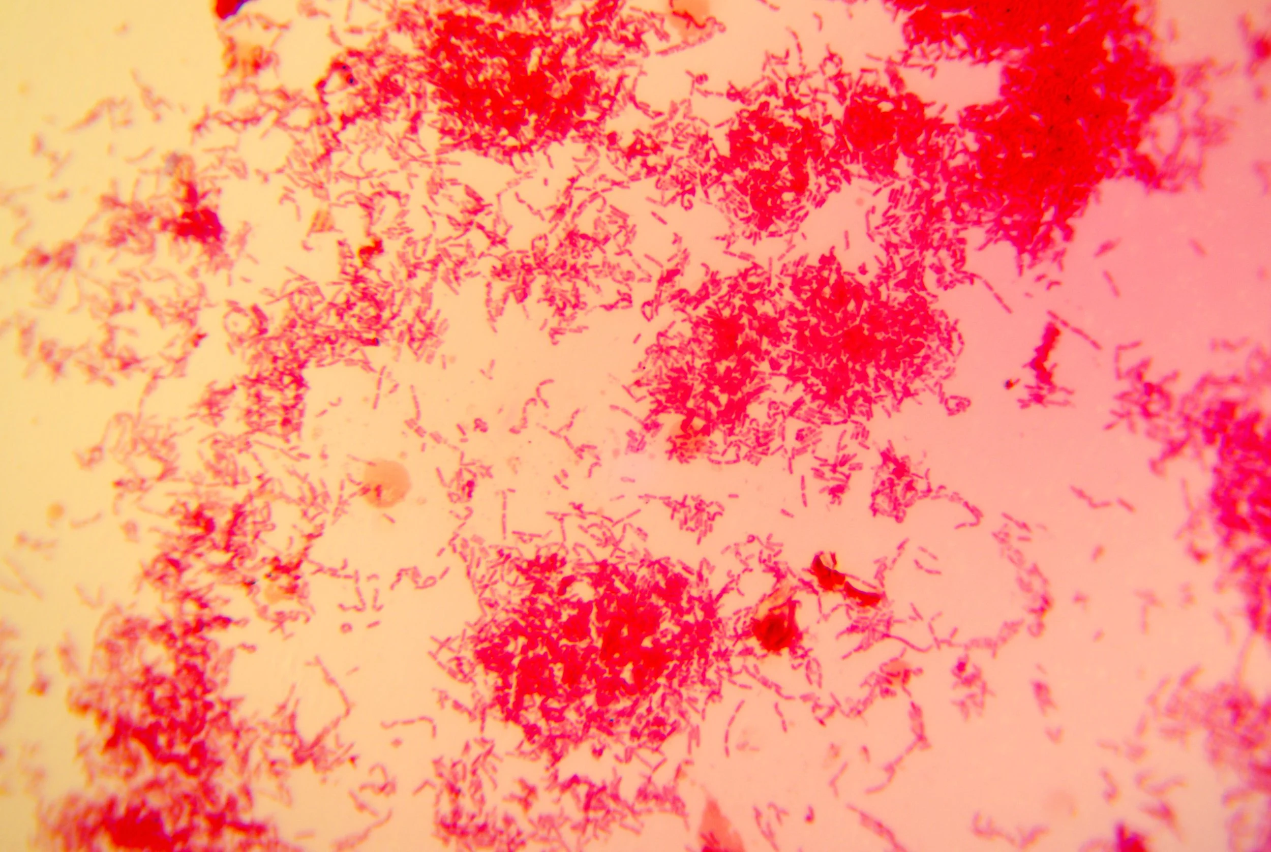 bacilus anthracis20251216234134134.jpg