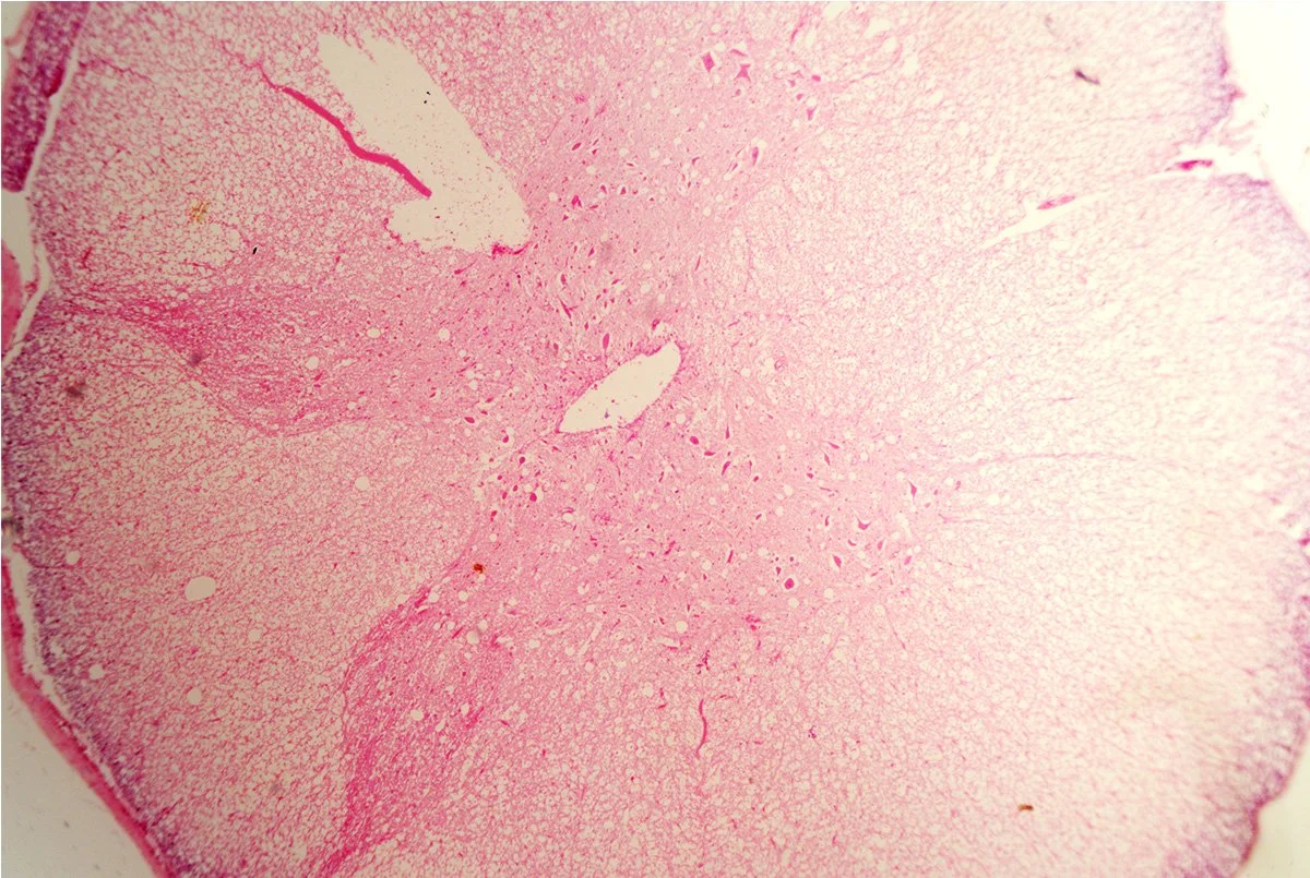 Spinal Cord Cross Section 8.jpg