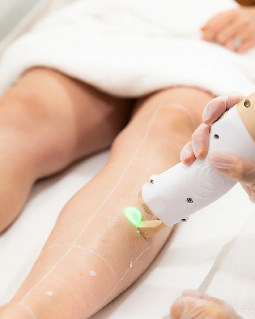 &Eacute;pilation laser &ndash; Maison Peaux

Une peau douce, nette et sans poils&hellip; durablement !
Nous r&eacute;alisons l&rsquo;&eacute;pilation laser avec la plus grande pr&eacute;cision, en adaptant chaque s&eacute;ance &agrave; votre phototyp