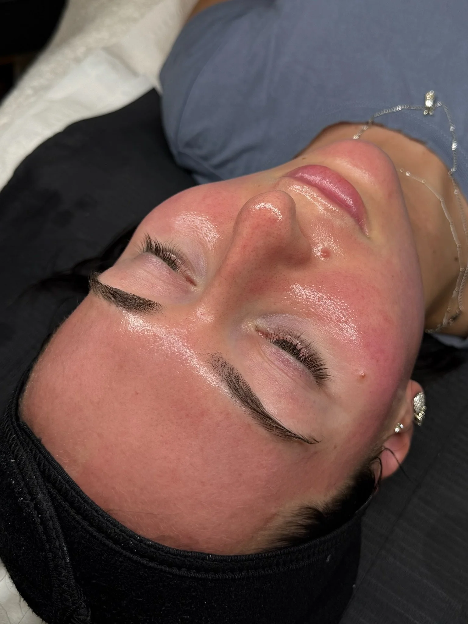 Client results after beauty treatment.