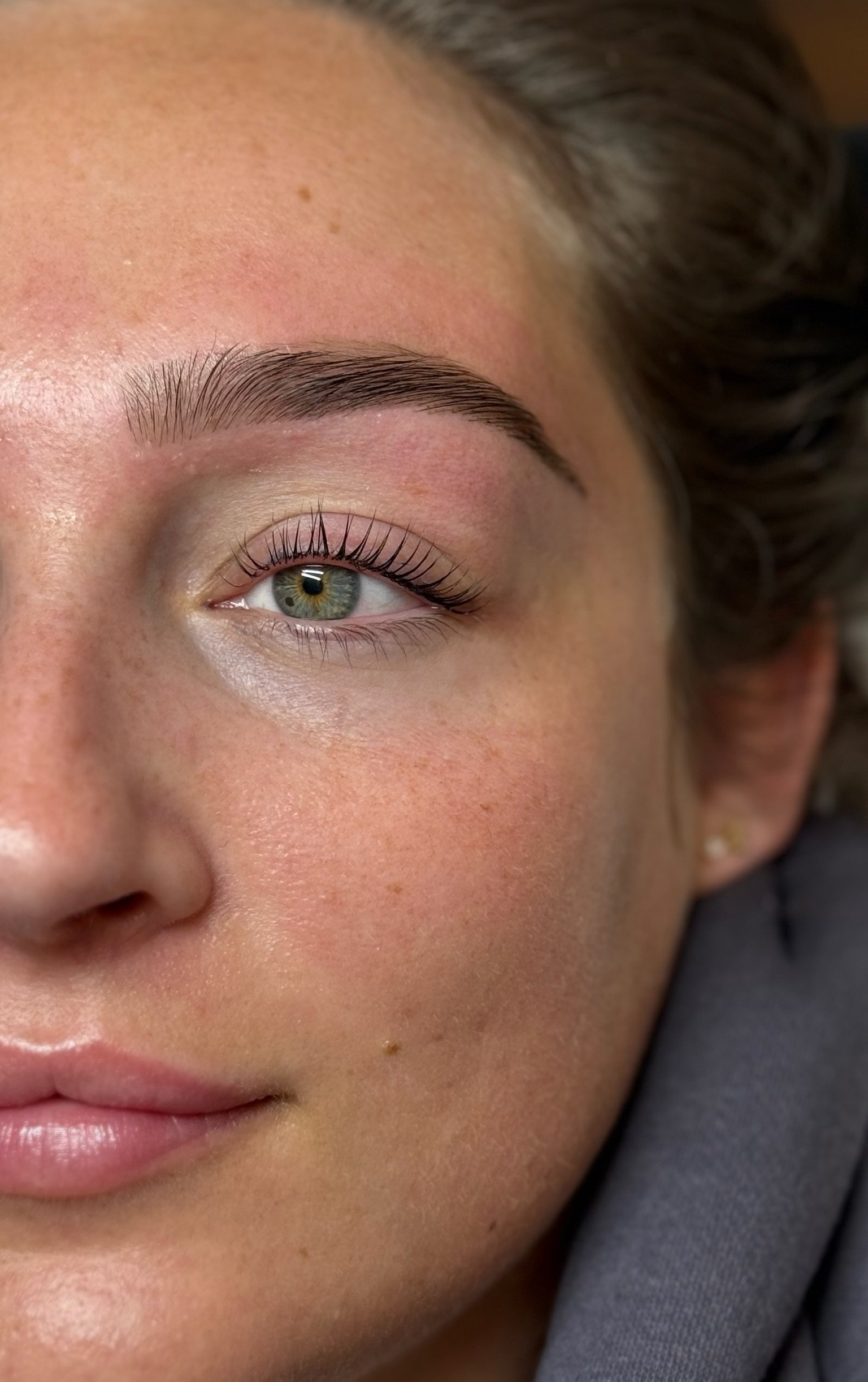 Client results after beauty treatment.