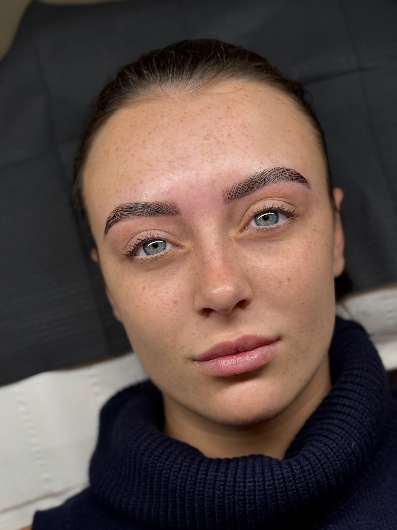 Client results after beauty treatment.