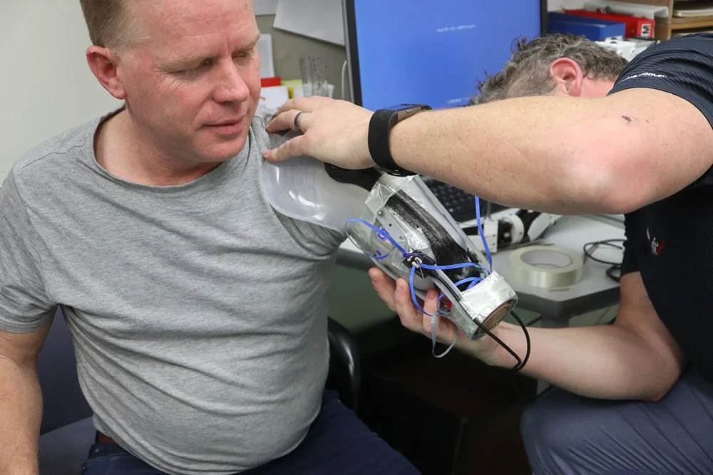 Jason’s Bionic Arm