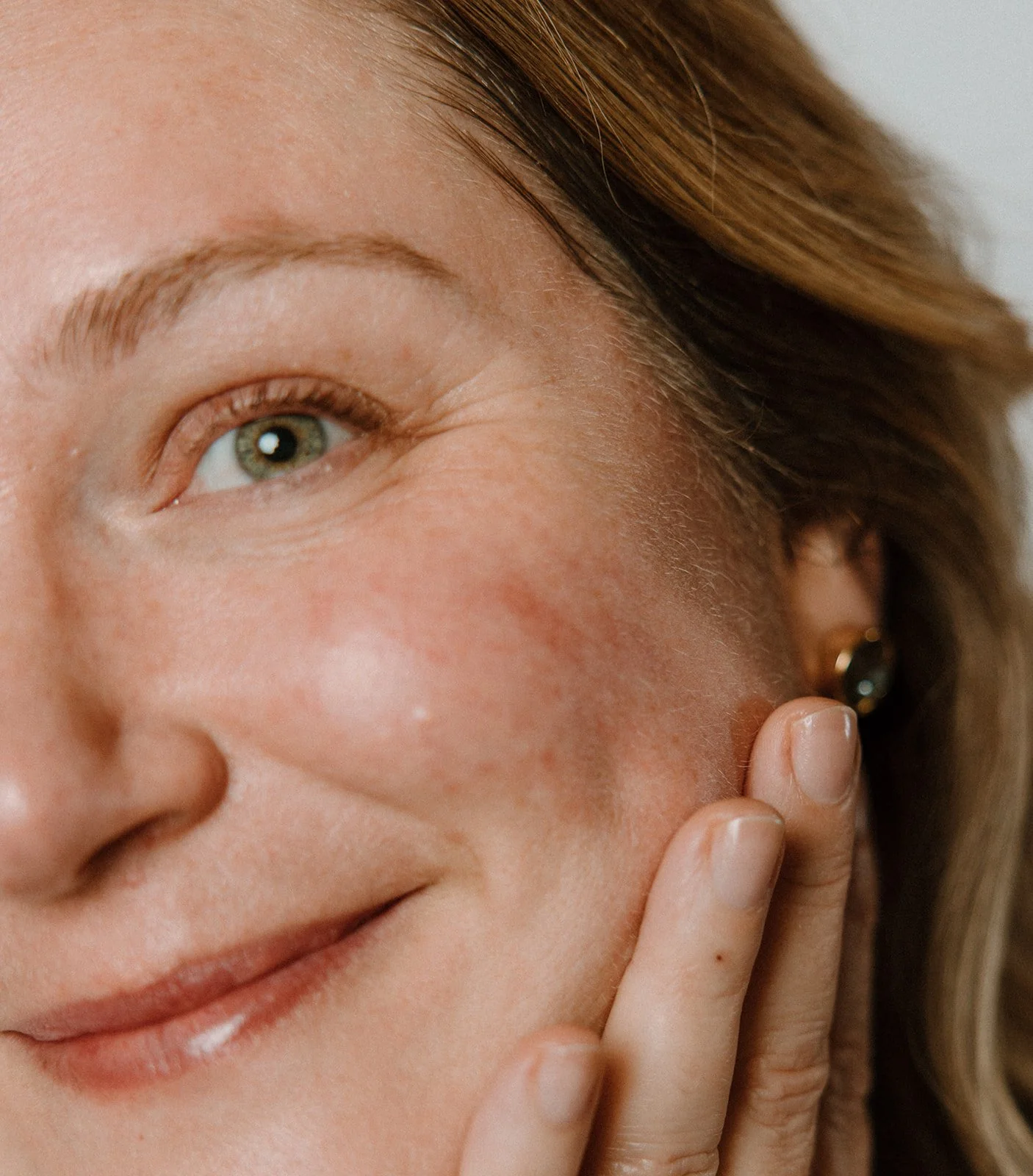 Healthy Skin Isn’t Perfect Skin. Here’s What It Actually Looks Like.