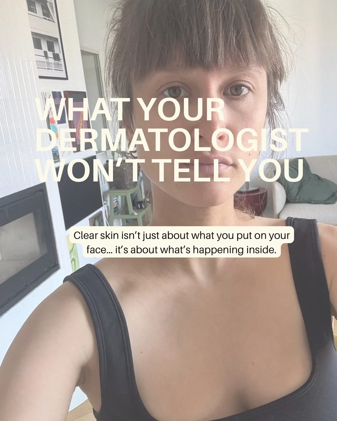💡 What your dermatologist won&rsquo;t tell you about the gut&ndash;skin connection

You&rsquo;ve probably been told to &ldquo;just use this cream&rdquo; or &ldquo;try this antibiotic&rdquo;.
 And yes, your skin might calm down&hellip; for a while. B