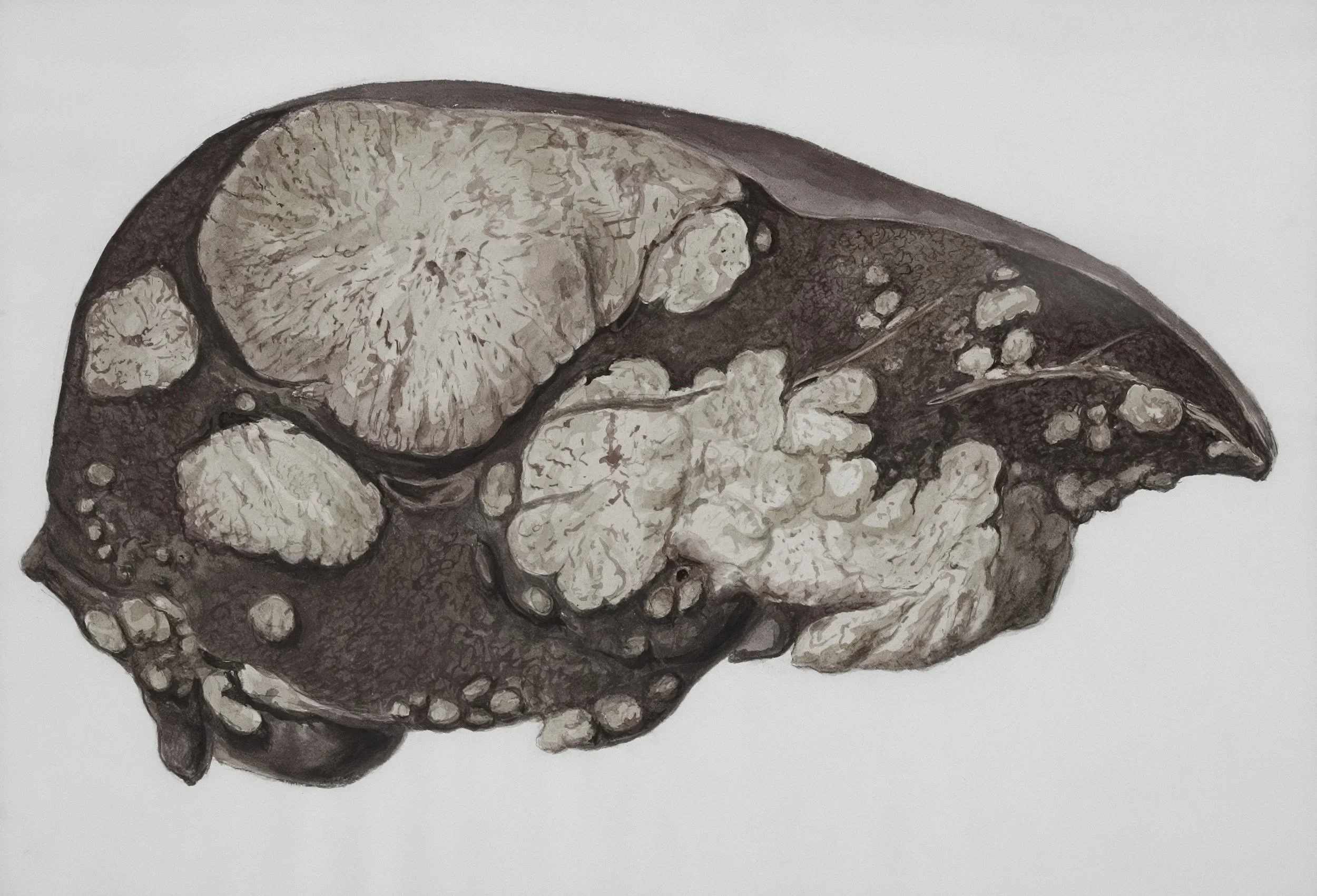 The Role of the Liver in Chronic Skin Conditions (And Why Detoxes Often Fail)