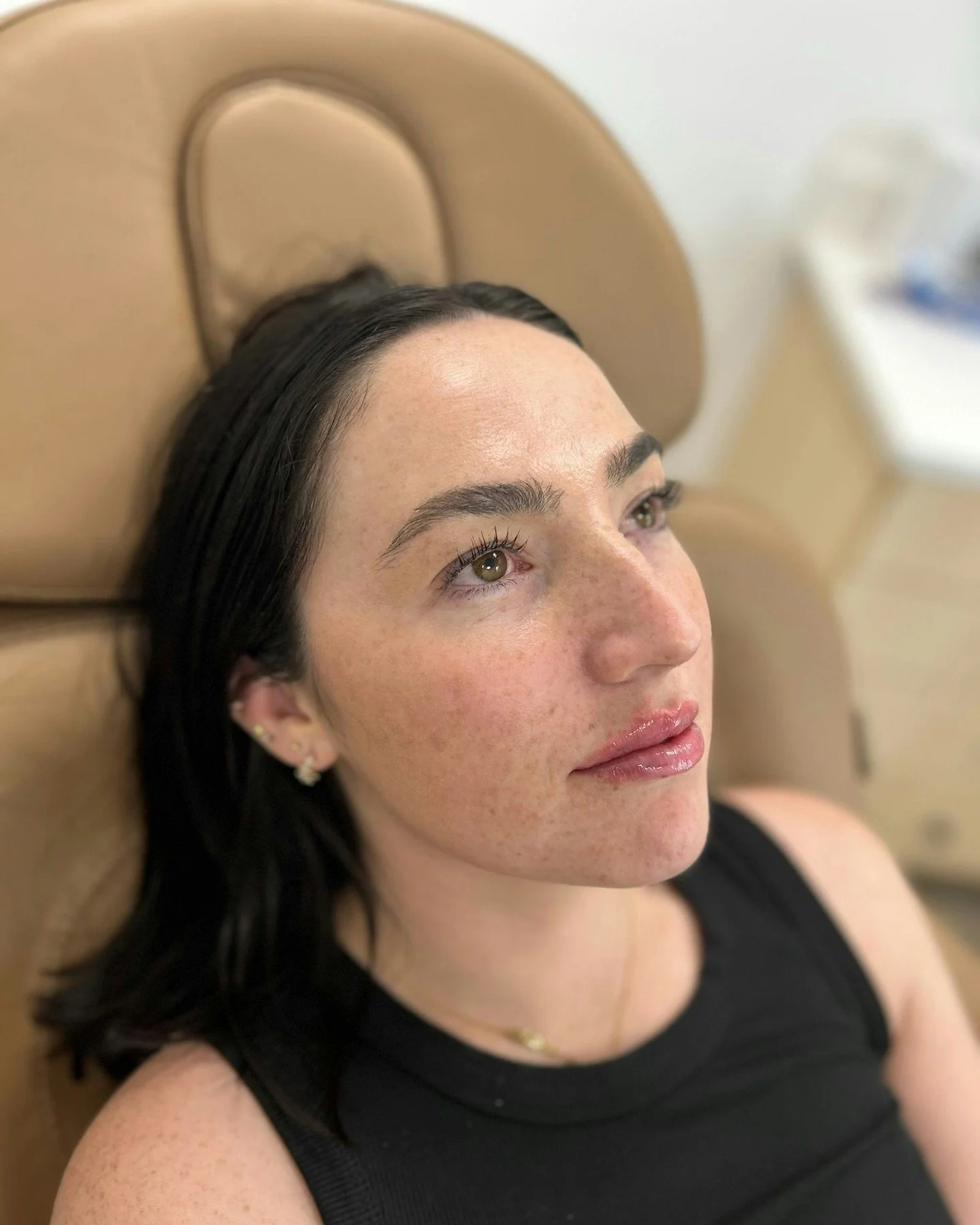 A little filler Friday! 💉 👄 

Soft, hydrated, and beautifully balanced lips by @aestheticnurse_emily &mdash; Ready for your own lip refresh? Book your consultation today.