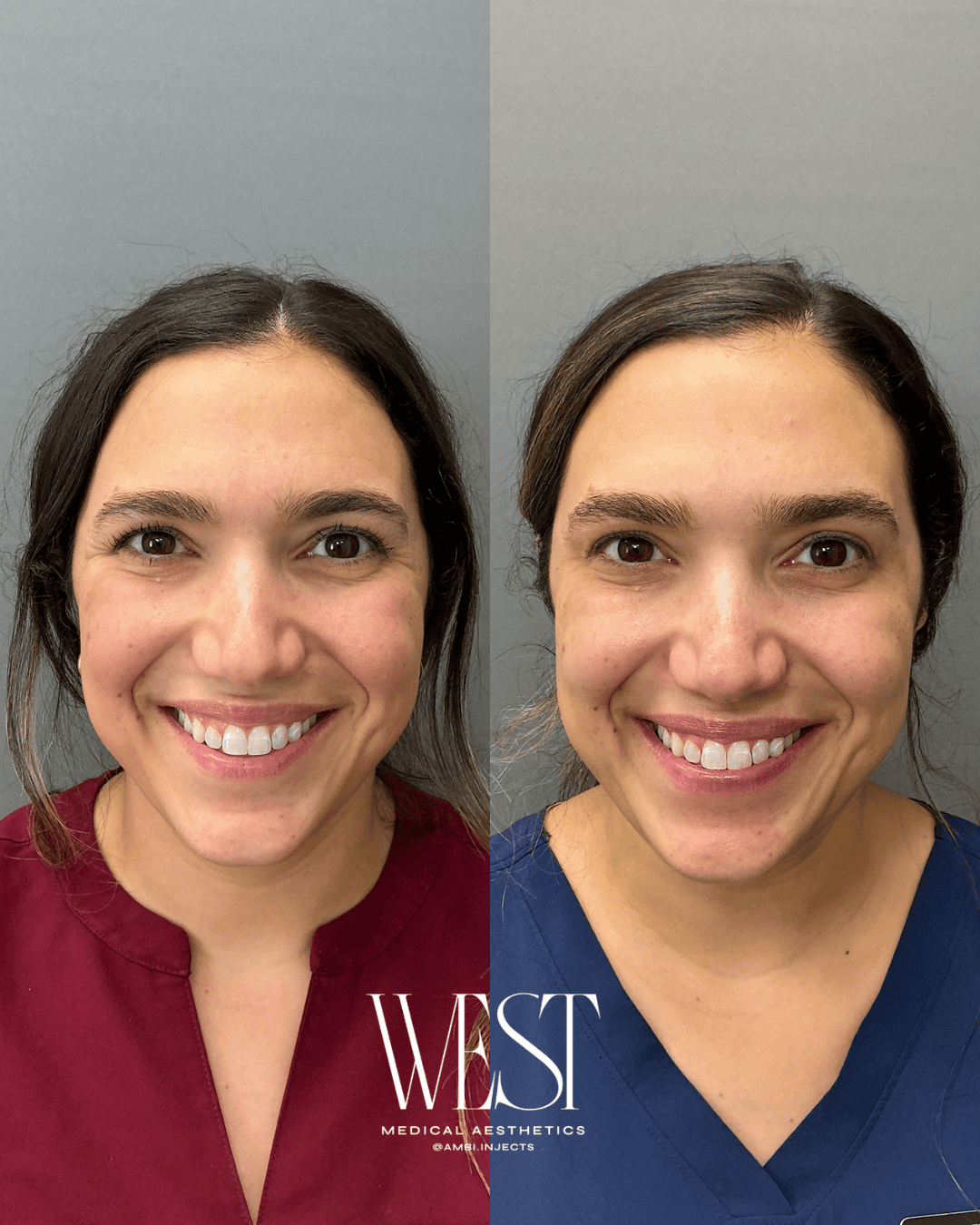 Dysport injectable in okc