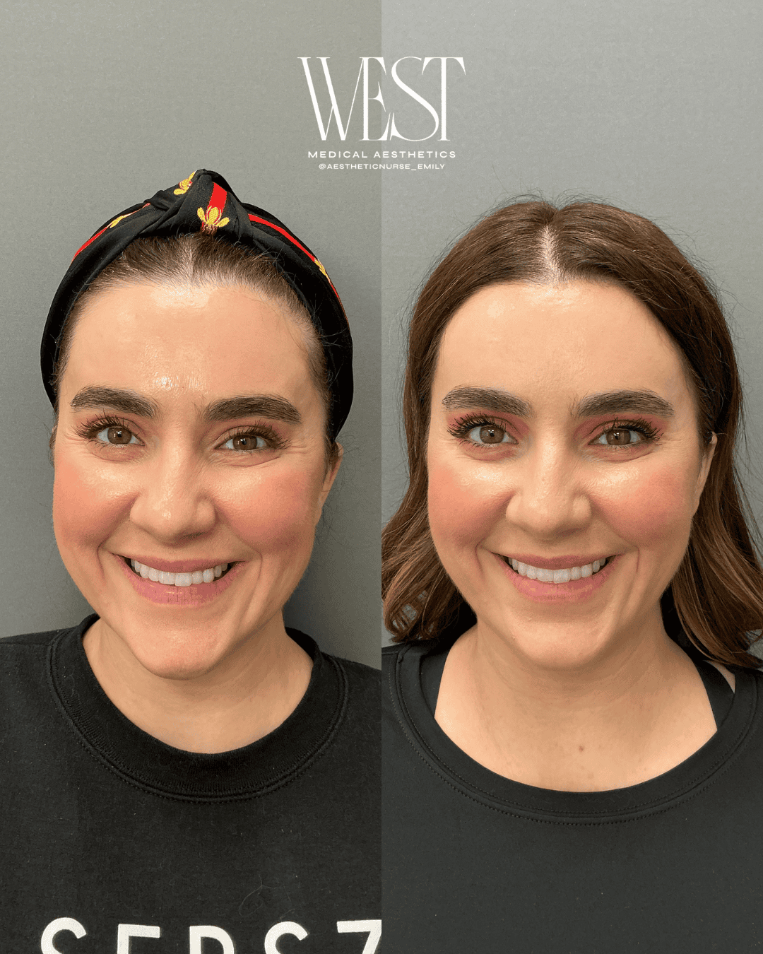 Daxxify Injectable in OKC