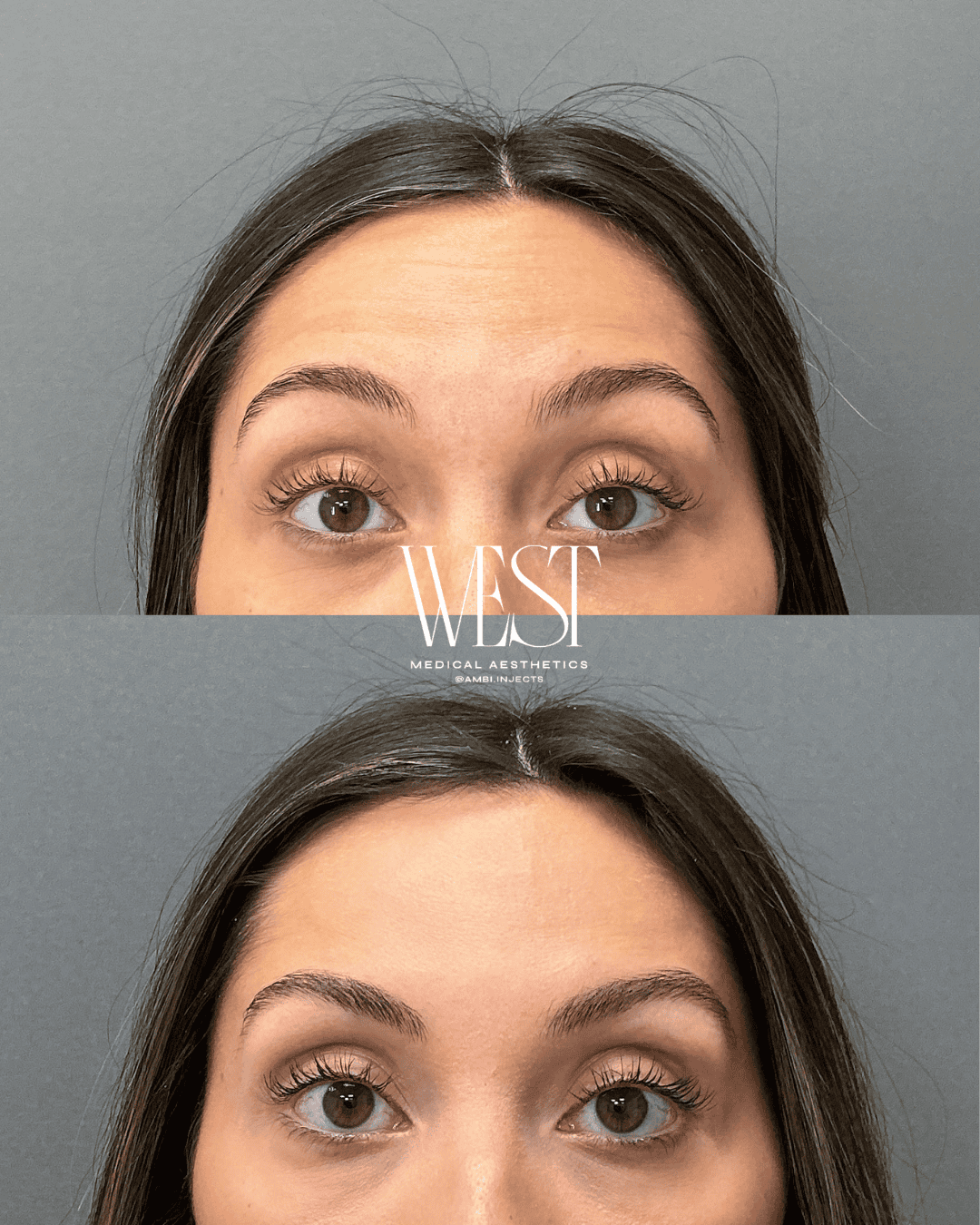 Dysport injectables in OKC