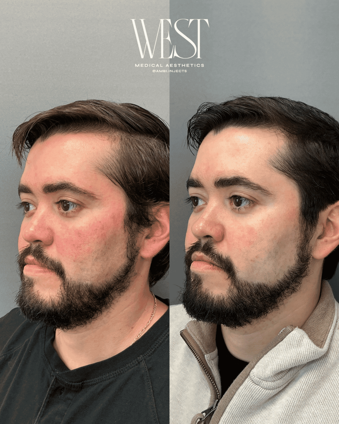 Mens Laser skin treatment in okc