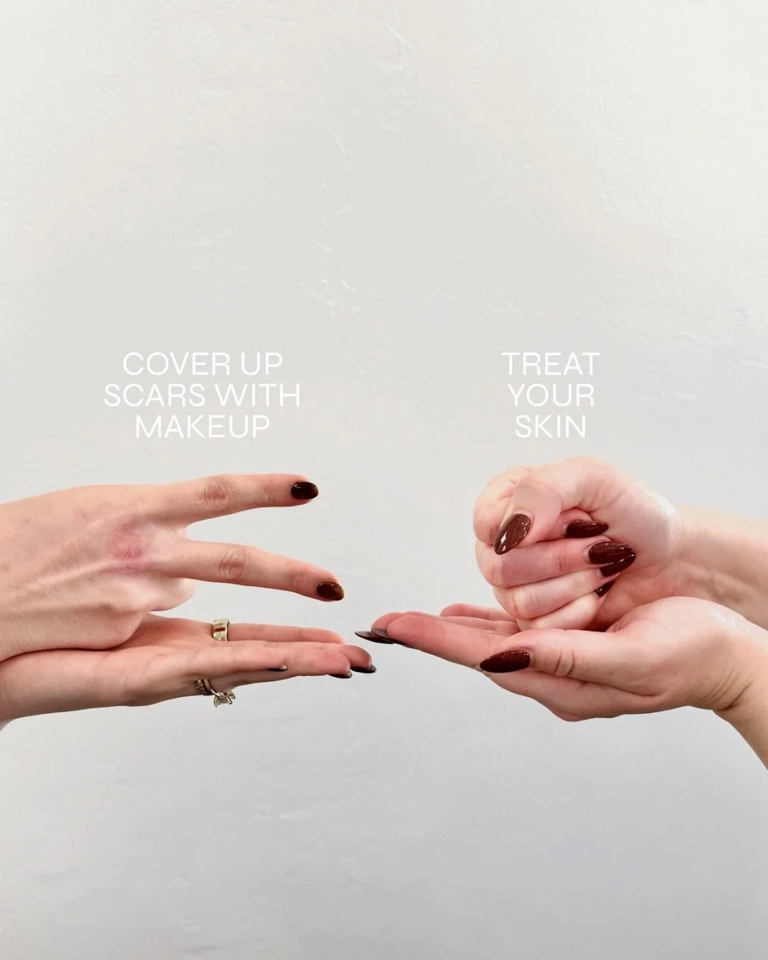 Rock, paper, scissors&hellip; West always wins. ✨
Consider this your sign to book the appointment.

#okcmedspa #medspacontent #okcaesthetician #okcaesthetics #westmedspa
