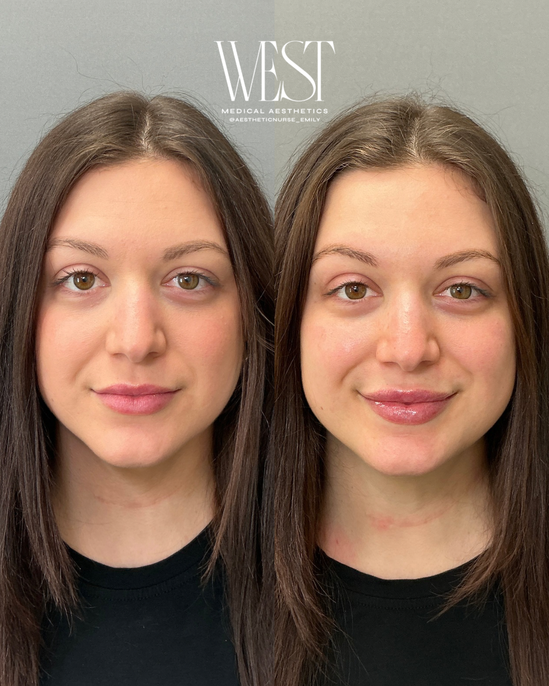 Before + Afters - 341.PNG