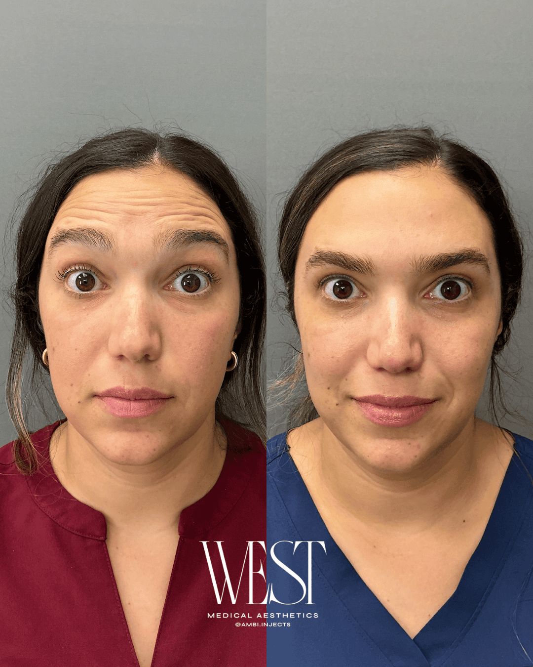 Dysport injectable in okc