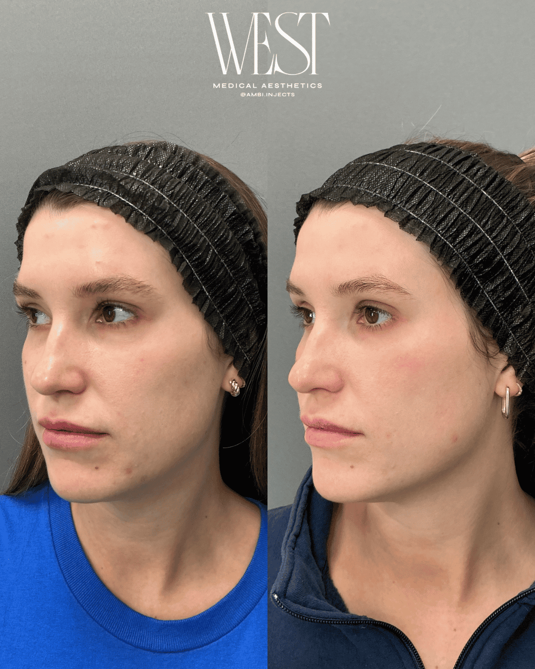 Top Laser skin treatment in okc